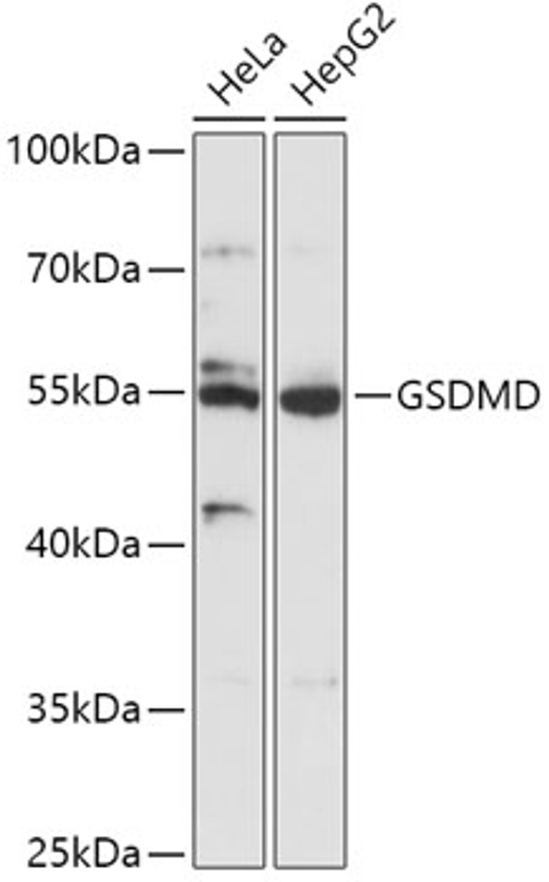 Western blot analysis of extracts of various cell lines, using GSDMD antibody (16-910) at 1:1000 dilution.<br/>Secondary antibody: HRP Goat Anti-Rabbit IgG (H+L) at 1:10000 dilution.<br/>Lysates/proteins: 25ug per lane.<br/>Blocking buffer: 3% nonfat dry milk in TBST.<br/>Detection: ECL Basic Kit.<br/>Exposure time: 90s.
