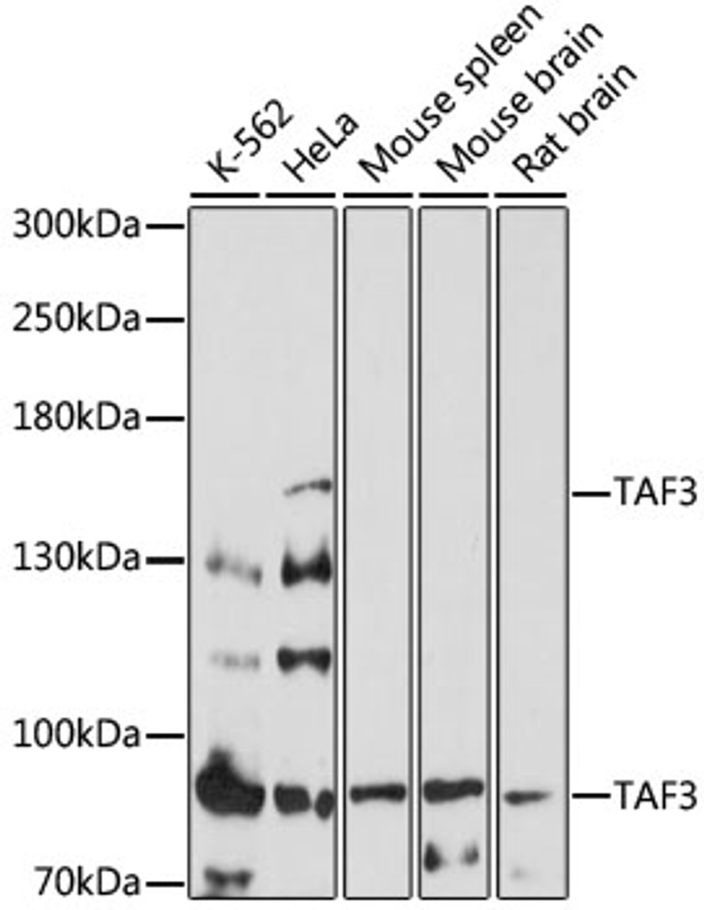 Western blot analysis of extracts of various cell lines, using TAF3 antibody (16-926) at 1:1000 dilution.<br/>Secondary antibody: HRP Goat Anti-Rabbit IgG (H+L) at 1:10000 dilution.<br/>Lysates/proteins: 25ug per lane.<br/>Blocking buffer: 3% nonfat dry milk in TBST.<br/>Detection: ECL Basic Kit.<br/>Exposure time: 3min.
