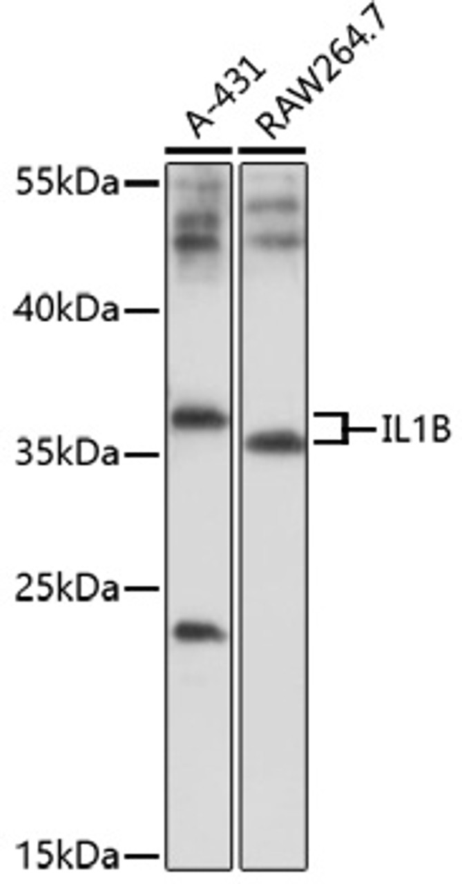 Western blot analysis of extracts of various cells, using IL1B antibody (16-928) at 1:1000 dilution.<br/>Secondary antibody: HRP Goat Anti-Rabbit IgG (H+L) at 1:10000 dilution.<br/>Lysates/proteins: 25ug per lane.<br/>Blocking buffer: 3% nonfat dry milk in TBST.<br/>Detection: ECL Basic Kit.<br/>Exposure time: 30s.