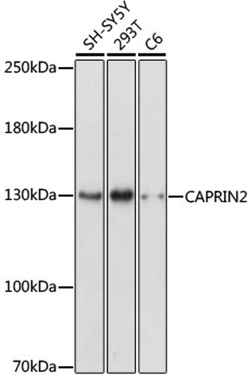 Western blot analysis of extracts of various cell lines, using CAPRIN2 antibody (16-930) at 1:1000 dilution.<br/>Secondary antibody: HRP Goat Anti-Rabbit IgG (H+L) at 1:10000 dilution.<br/>Lysates/proteins: 25ug per lane.<br/>Blocking buffer: 3% nonfat dry milk in TBST.<br/>Detection: ECL Enhanced Kit.<br/>Exposure time: 3min.