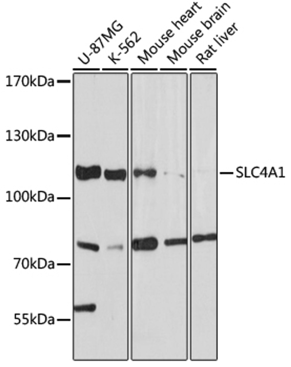 Western blot analysis of extracts of various cell lines, using SLC4A1 antibody (16-936) at 1:1000 dilution.<br/>Secondary antibody: HRP Goat Anti-Rabbit IgG (H+L) at 1:10000 dilution.<br/>Lysates/proteins: 25ug per lane.<br/>Blocking buffer: 3% nonfat dry milk in TBST.<br/>Detection: ECL Basic Kit.<br/>Exposure time: 30s.