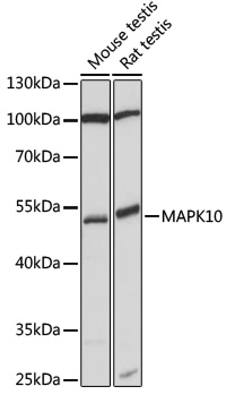 Western blot analysis of extracts of various cell lines, using MAPK10 antibody (16-937) at 1:1000 dilution.<br/>Secondary antibody: HRP Goat Anti-Rabbit IgG (H+L) at 1:10000 dilution.<br/>Lysates/proteins: 25ug per lane.<br/>Blocking buffer: 3% nonfat dry milk in TBST.<br/>Detection: ECL Basic Kit.<br/>Exposure time: 30s.