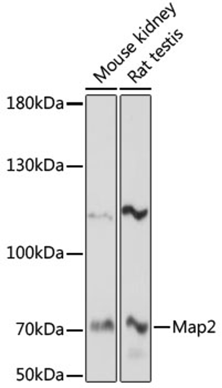Western blot analysis of extracts of various cell lines, using Map2 antibody (16-938) at 1:1000 dilution.<br/>Secondary antibody: HRP Goat Anti-Rabbit IgG (H+L) at 1:10000 dilution.<br/>Lysates/proteins: 25ug per lane.<br/>Blocking buffer: 3% nonfat dry milk in TBST.<br/>Detection: ECL Basic Kit.<br/>Exposure time: 90s.