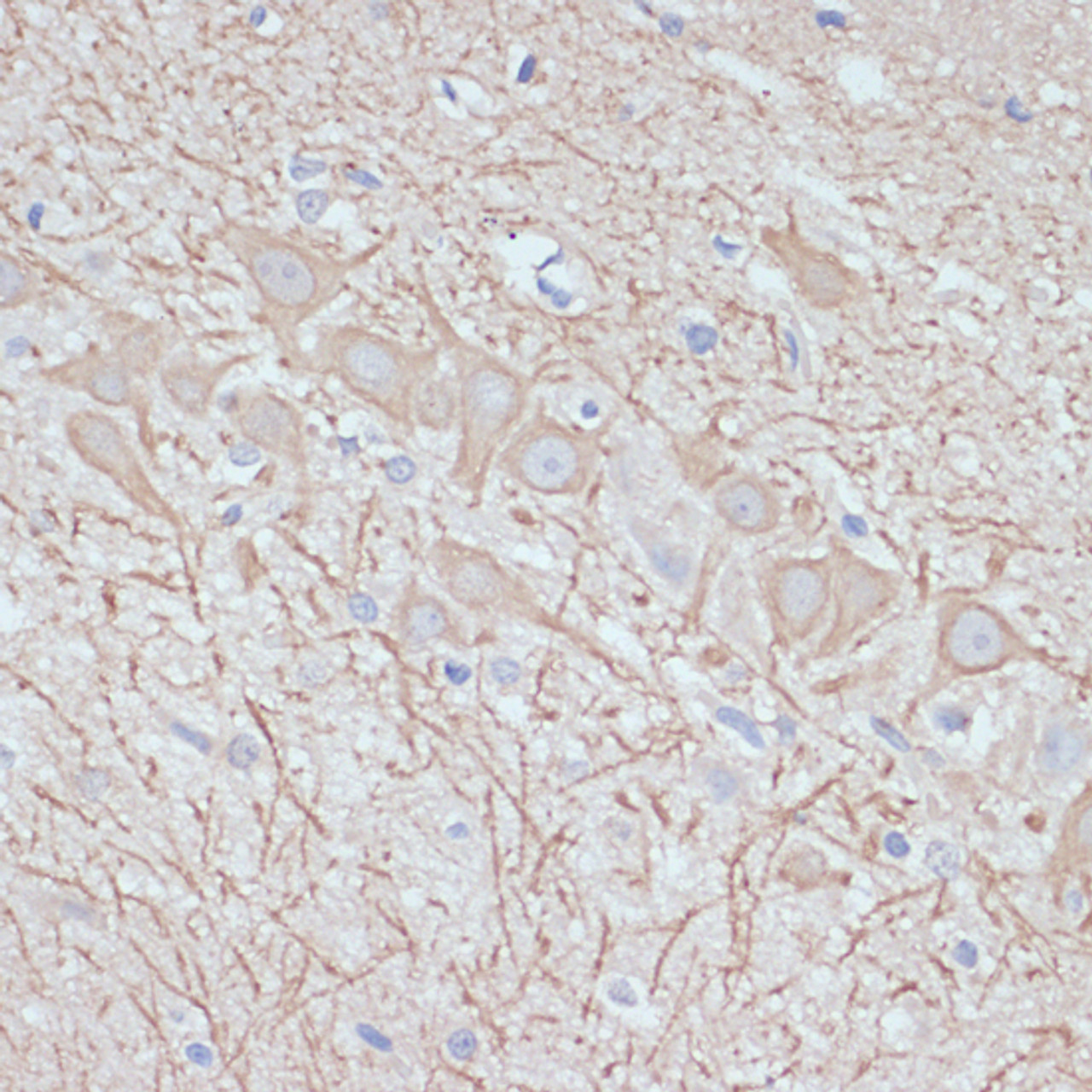 Immunohistochemistry of paraffin-embedded rat brain using Map2 antibody (16-938) at dilution of 1:100 (40x lens) .