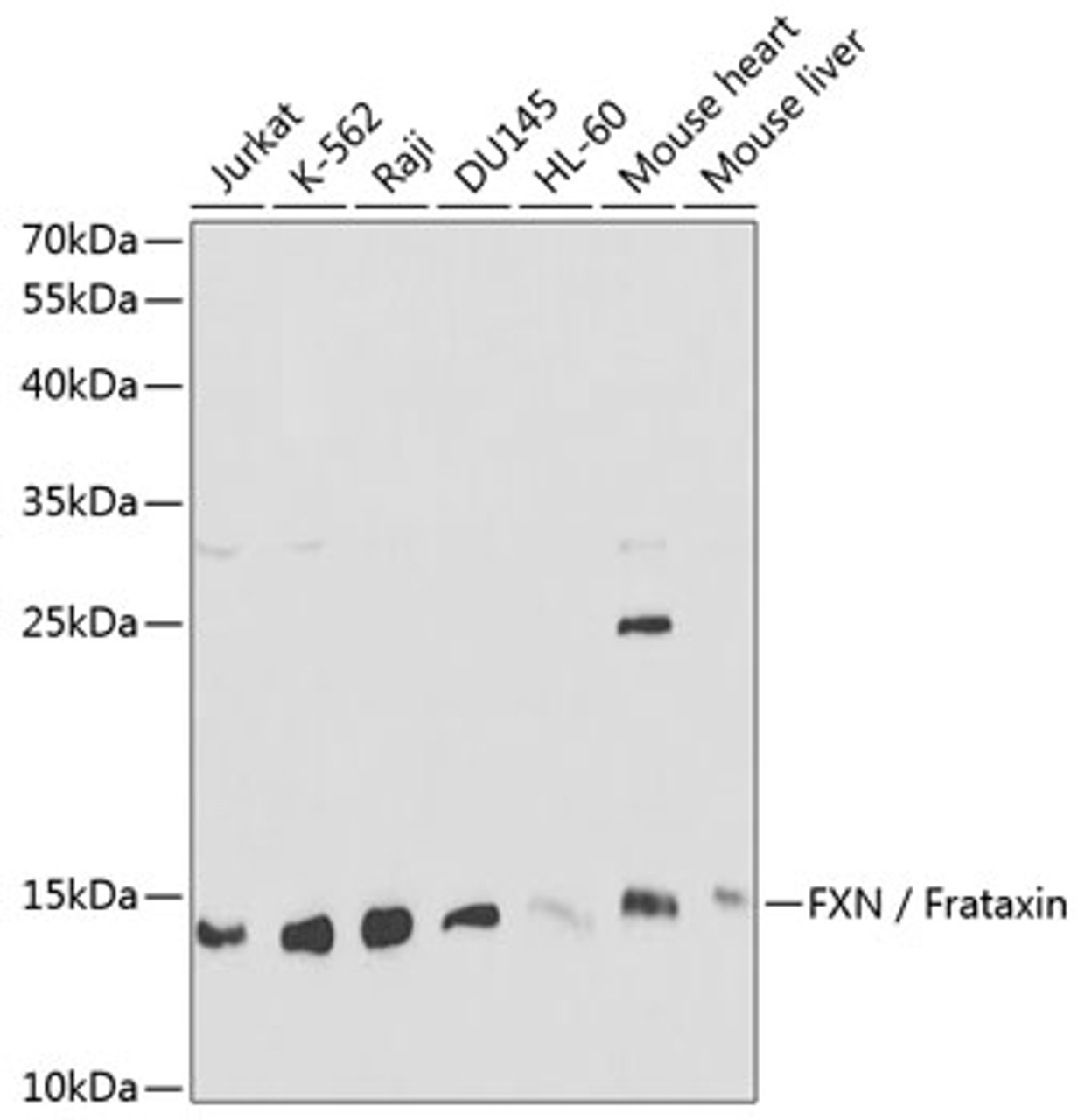 Western blot analysis of extracts of various cell lines, using FXN / Frataxin antibody (16-947) at 1:1000 dilution.<br/>Secondary antibody: HRP Goat Anti-Rabbit IgG (H+L) at 1:10000 dilution.<br/>Lysates/proteins: 25ug per lane.<br/>Blocking buffer: 3% nonfat dry milk in TBST.