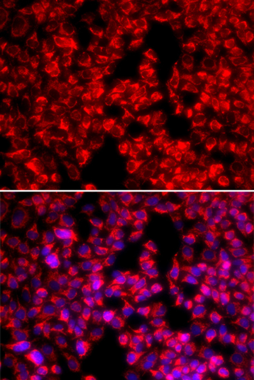 Immunofluorescence analysis of U2OS cells using MTTP antibody (16-950) . Blue: DAPI for nuclear staining.