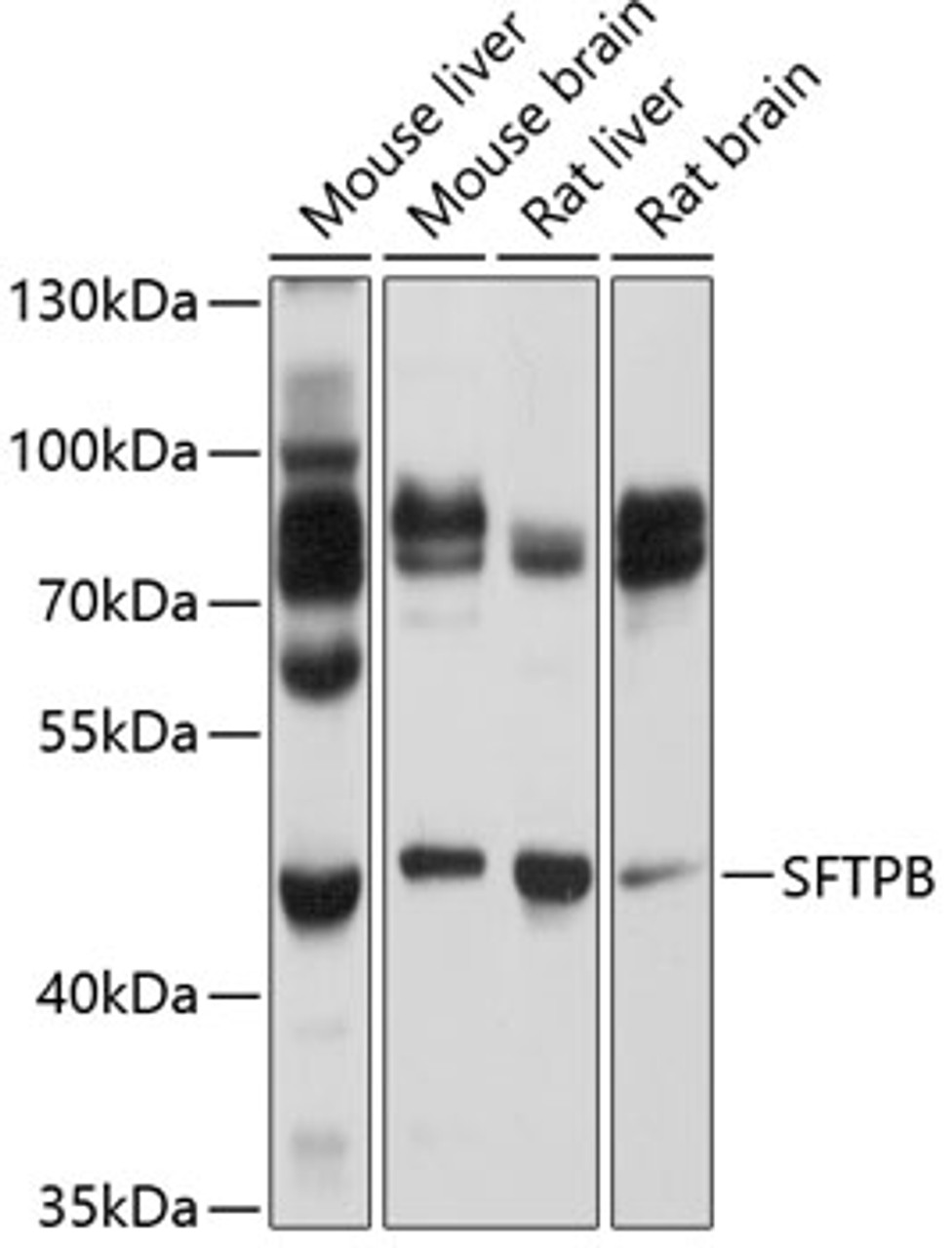 Western blot analysis of extracts of various cell lines, using SFTPB Antibody (16-955) at 1:1000 dilution.<br/>Secondary antibody: HRP Goat Anti-Rabbit IgG (H+L) at 1:10000 dilution.<br/>Lysates/proteins: 25ug per lane.<br/>Blocking buffer: 3% nonfat dry milk in TBST.<br/>Detection: ECL Basic Kit.<br/>Exposure time: 3s.
