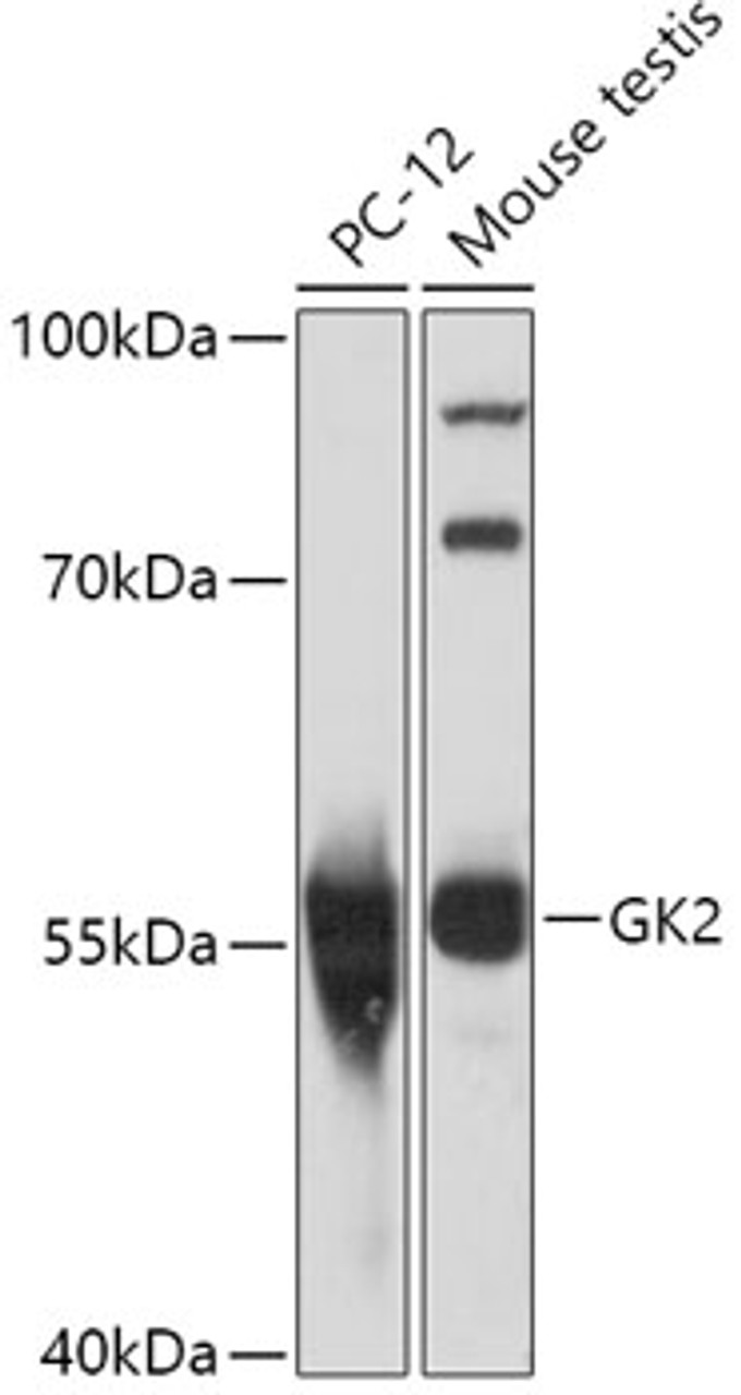 Western blot analysis of extracts of various cell lines, using GK2 antibody (16-956) at 1:1000 dilution.<br/>Secondary antibody: HRP Goat Anti-Rabbit IgG (H+L) at 1:10000 dilution.<br/>Lysates/proteins: 25ug per lane.<br/>Blocking buffer: 3% nonfat dry milk in TBST.<br/>Detection: ECL Basic Kit.<br/>Exposure time: 15s.