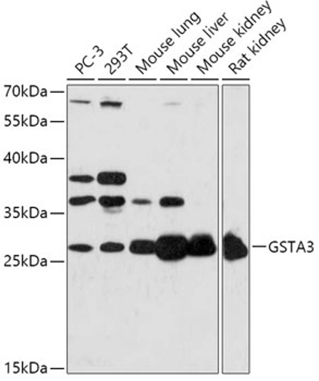 Western blot analysis of extracts of various cell lines, using GSTA3 antibody (16-957) at 1:1000 dilution.<br/>Secondary antibody: HRP Goat Anti-Rabbit IgG (H+L) at 1:10000 dilution.<br/>Lysates/proteins: 25ug per lane.<br/>Blocking buffer: 3% nonfat dry milk in TBST.<br/>Detection: ECL Basic Kit.<br/>Exposure time: 3min.