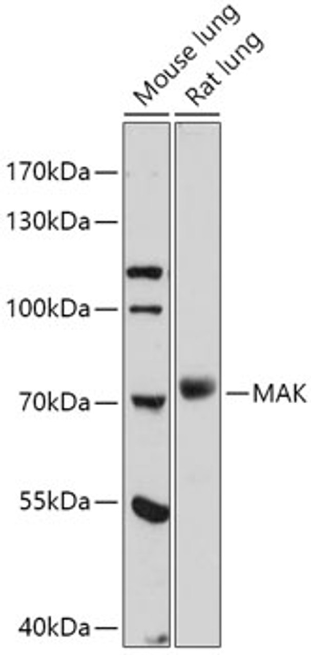 Western blot analysis of extracts of various cell lines, using MAK antibody (16-963) at 1:1000 dilution.<br/>Secondary antibody: HRP Goat Anti-Rabbit IgG (H+L) at 1:10000 dilution.<br/>Lysates/proteins: 25ug per lane.<br/>Blocking buffer: 3% nonfat dry milk in TBST.<br/>Detection: ECL Basic Kit.<br/>Exposure time: 90s.