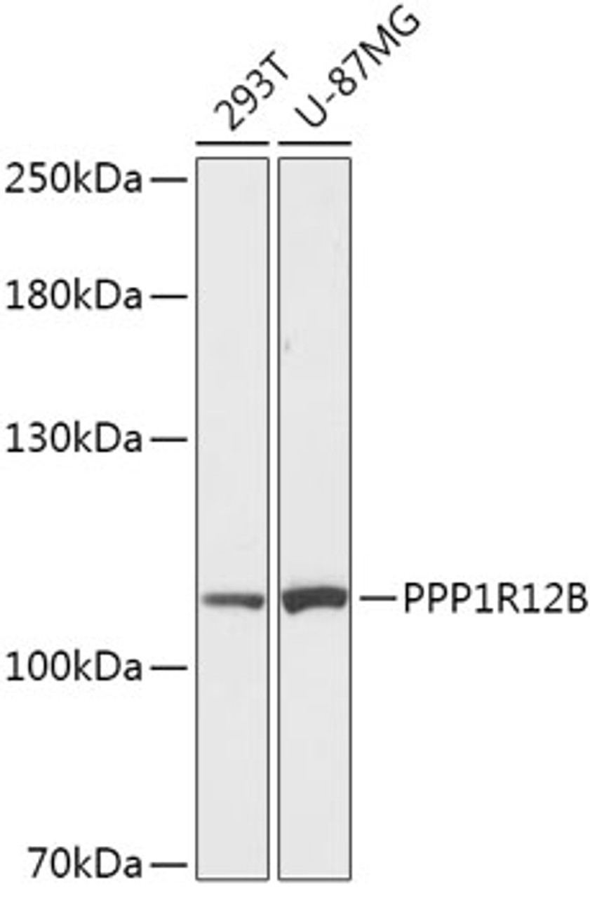 Western blot analysis of extracts of various cell lines, using PPP1R12B antibody (16-965) at 1:1000 dilution.<br/>Secondary antibody: HRP Goat Anti-Rabbit IgG (H+L) at 1:10000 dilution.<br/>Lysates/proteins: 25ug per lane.<br/>Blocking buffer: 3% nonfat dry milk in TBST.<br/>Detection: ECL Basic Kit.<br/>Exposure time: 90s.