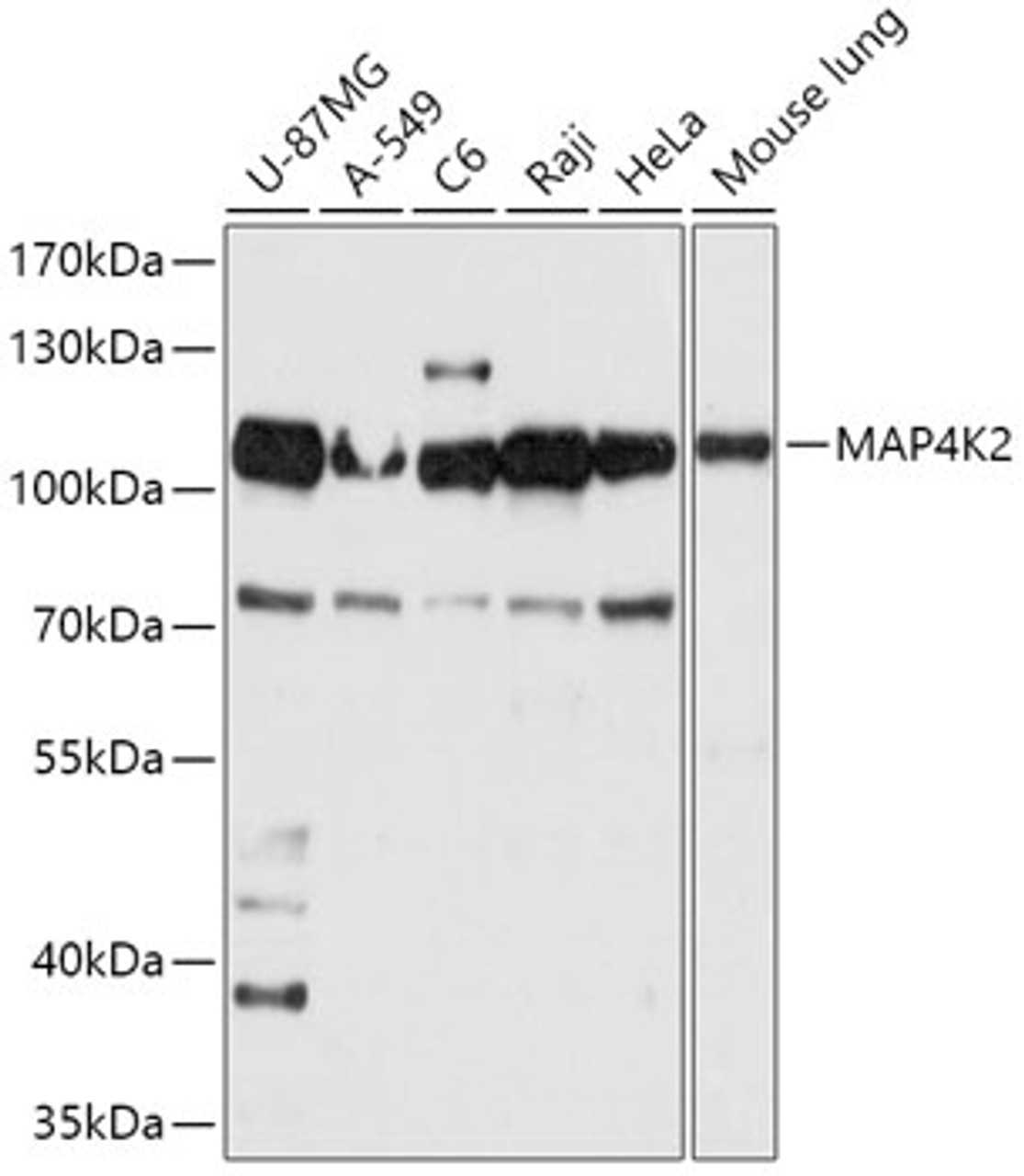 Western blot analysis of extracts of various cell lines, using MAP4K2 antibody (16-970) at 1:1000 dilution.<br/>Secondary antibody: HRP Goat Anti-Rabbit IgG (H+L) at 1:10000 dilution.<br/>Lysates/proteins: 25ug per lane.<br/>Blocking buffer: 3% nonfat dry milk in TBST.<br/>Detection: ECL Basic Kit.<br/>Exposure time: 10s.