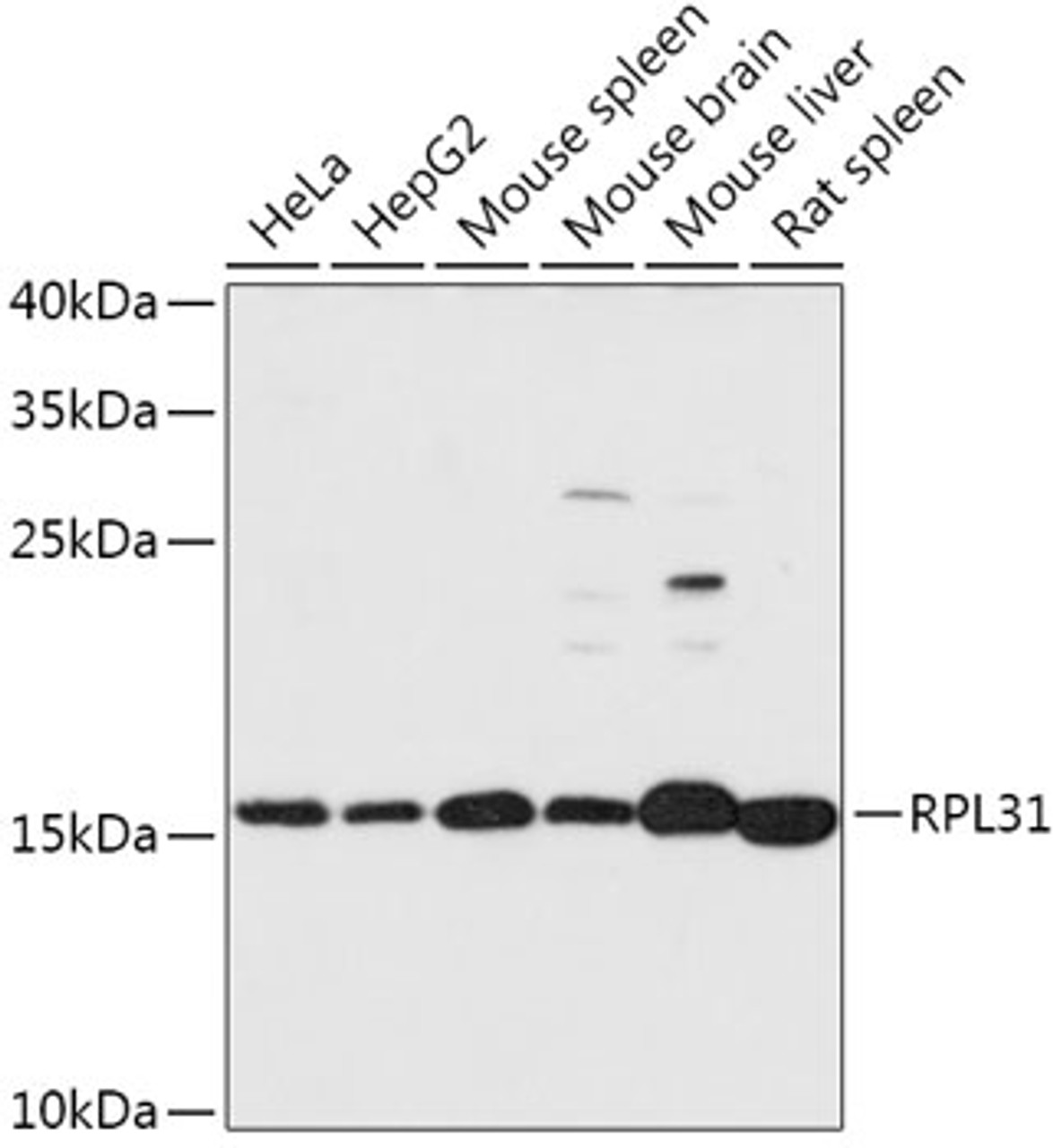 Western blot analysis of extracts of various cell lines, using RPL31 antibody (16-971) at 1:1000 dilution.<br/>Secondary antibody: HRP Goat Anti-Rabbit IgG (H+L) at 1:10000 dilution.<br/>Lysates/proteins: 25ug per lane.<br/>Blocking buffer: 3% nonfat dry milk in TBST.<br/>Detection: ECL Basic Kit.<br/>Exposure time: 30s.