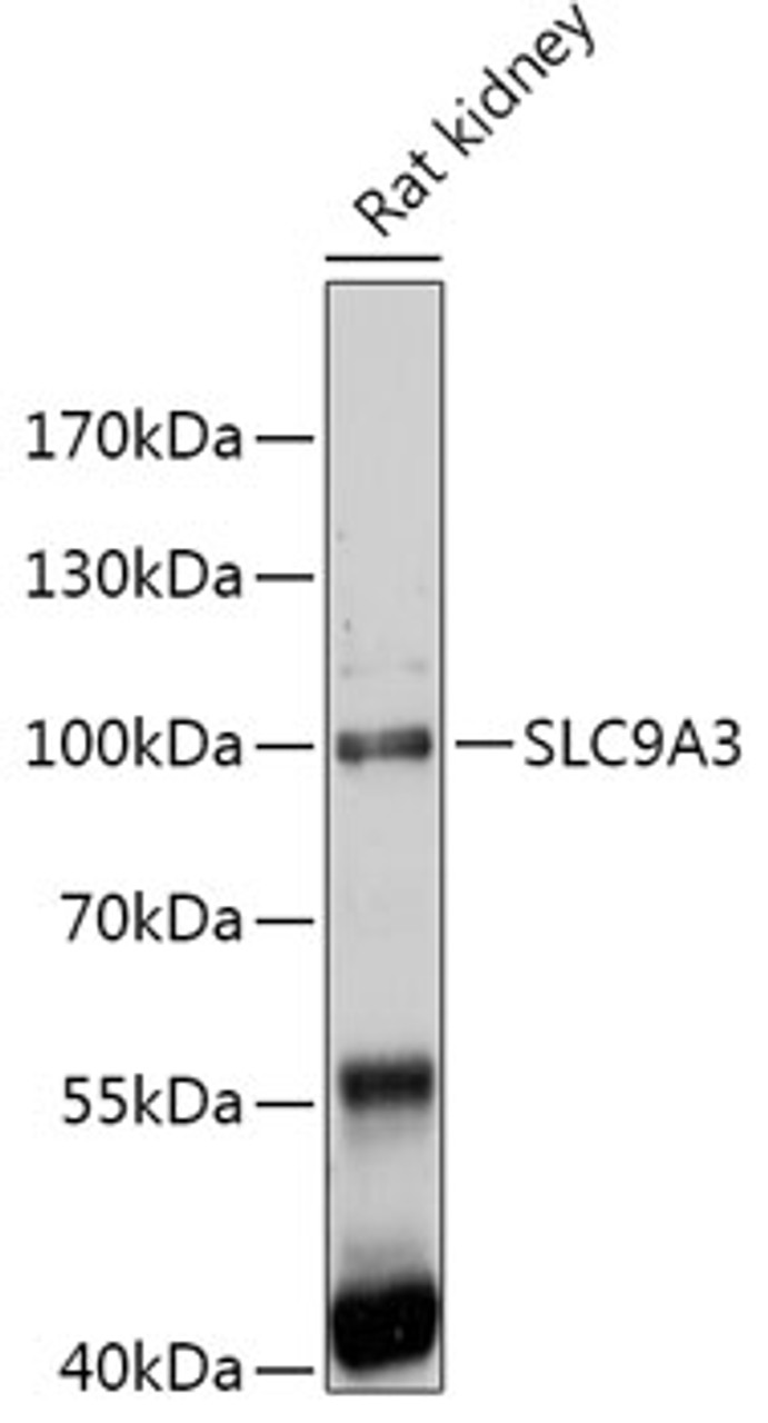 Western blot analysis of extracts of Rat kidney, using SLC9A3 antibody (16-975) at 1:1000 dilution.<br/>Secondary antibody: HRP Goat Anti-Rabbit IgG (H+L) at 1:10000 dilution.<br/>Lysates/proteins: 25ug per lane.<br/>Blocking buffer: 3% nonfat dry milk in TBST.<br/>Detection: ECL Enhanced Kit.<br/>Exposure time: 120s.