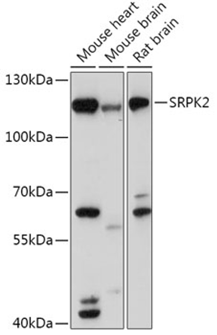 Western blot analysis of extracts of various cell lines, using SRPK2 antibody (16-977) at 1:1000 dilution.<br/>Secondary antibody: HRP Goat Anti-Rabbit IgG (H+L) at 1:10000 dilution.<br/>Lysates/proteins: 25ug per lane.<br/>Blocking buffer: 3% nonfat dry milk in TBST.<br/>Detection: ECL Basic Kit.<br/>Exposure time: 120s.