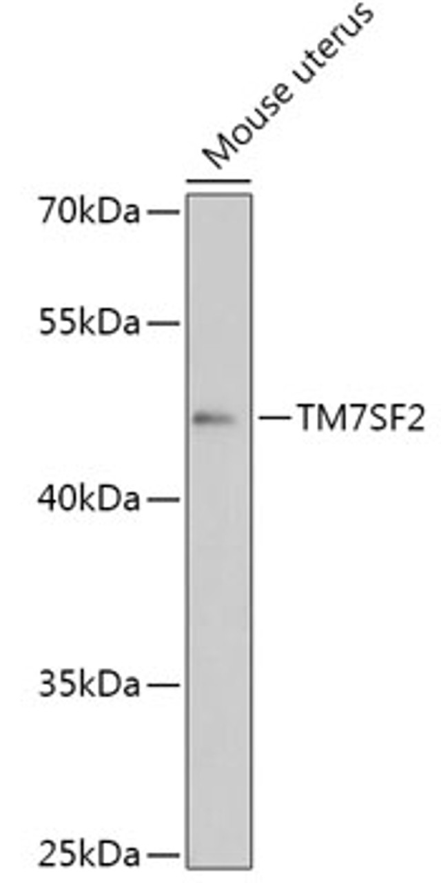 Western blot analysis of extracts of Mouse uterus, using TM7SF2 antibody (16-979) at 1:1000 dilution.<br/>Secondary antibody: HRP Goat Anti-Rabbit IgG (H+L) at 1:10000 dilution.<br/>Lysates/proteins: 25ug per lane.<br/>Blocking buffer: 3% nonfat dry milk in TBST.<br/>Detection: ECL Basic Kit.<br/>Exposure time: 90s.