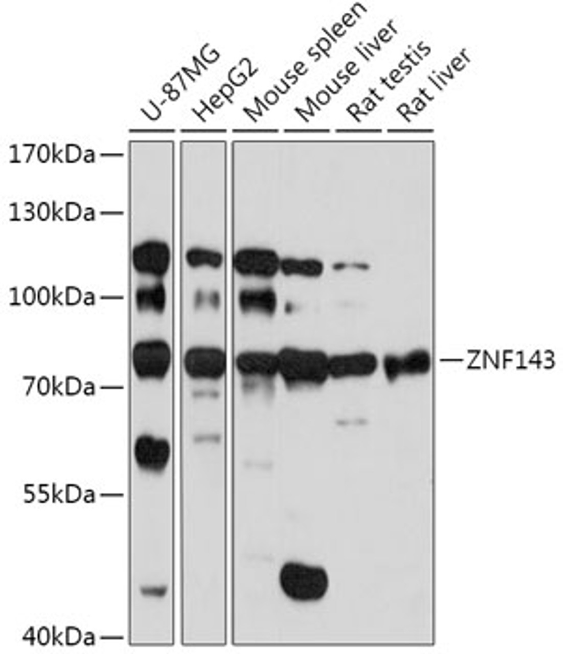 Western blot analysis of extracts of various cell lines, using ZNF143 antibody (16-983) at 1:1000 dilution.<br/>Secondary antibody: HRP Goat Anti-Rabbit IgG (H+L) at 1:10000 dilution.<br/>Lysates/proteins: 25ug per lane.<br/>Blocking buffer: 3% nonfat dry milk in TBST.<br/>Detection: ECL Basic Kit.<br/>Exposure time: 90s.