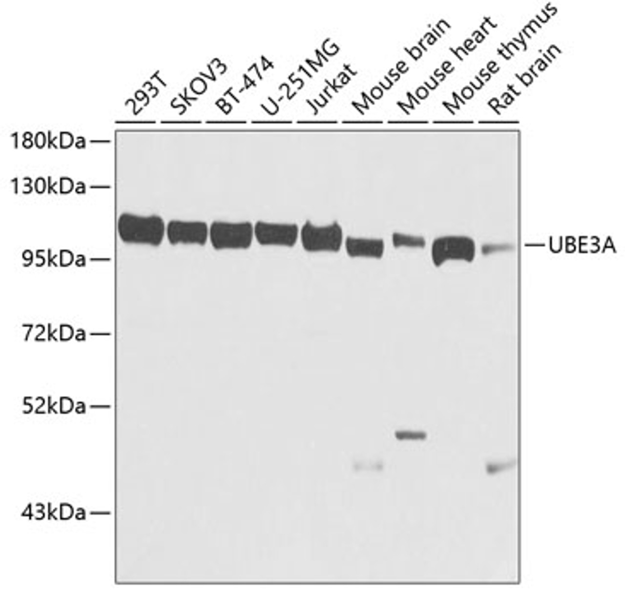 Western blot analysis of extracts of various cell lines, using UBE3A antibody (16-987) at 1:1000 dilution.<br/>Secondary antibody: HRP Goat Anti-Rabbit IgG (H+L) at 1:10000 dilution.<br/>Lysates/proteins: 25ug per lane.<br/>Blocking buffer: 3% nonfat dry milk in TBST.<br/>Detection: ECL Basic Kit.<br/>Exposure time: 5s.