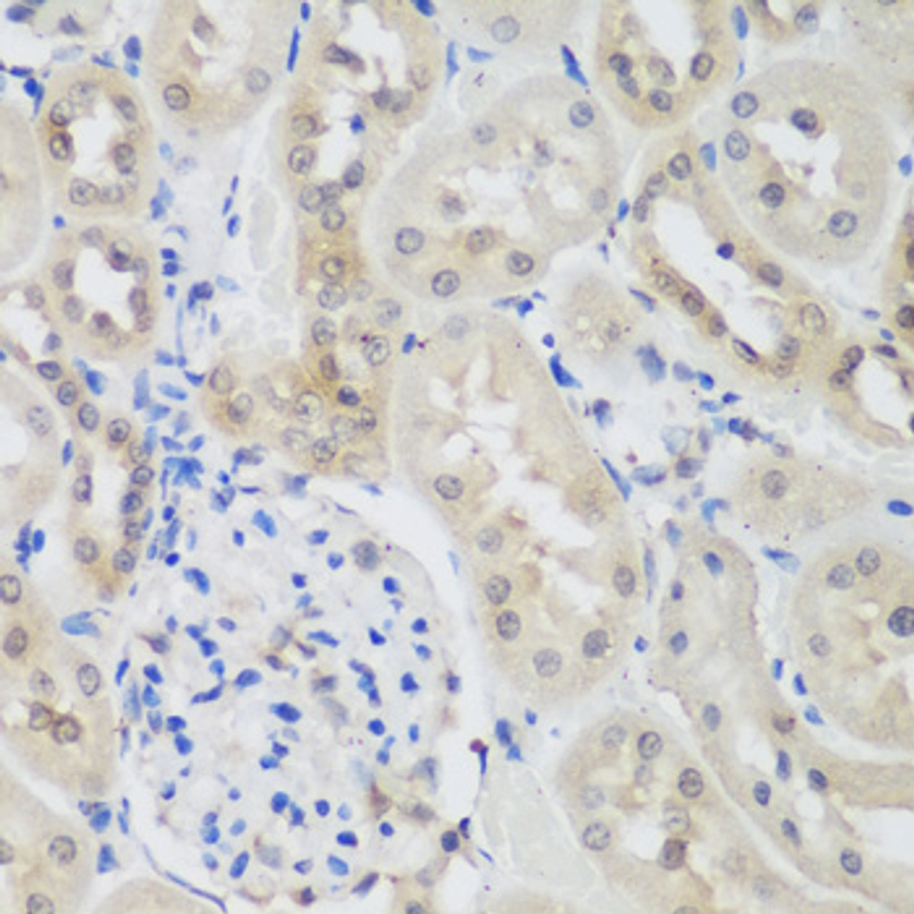 Immunohistochemistry of paraffin-embedded rat kidney using UBE3A antibody (16-987) at dilution of 1:200 (40x lens) .