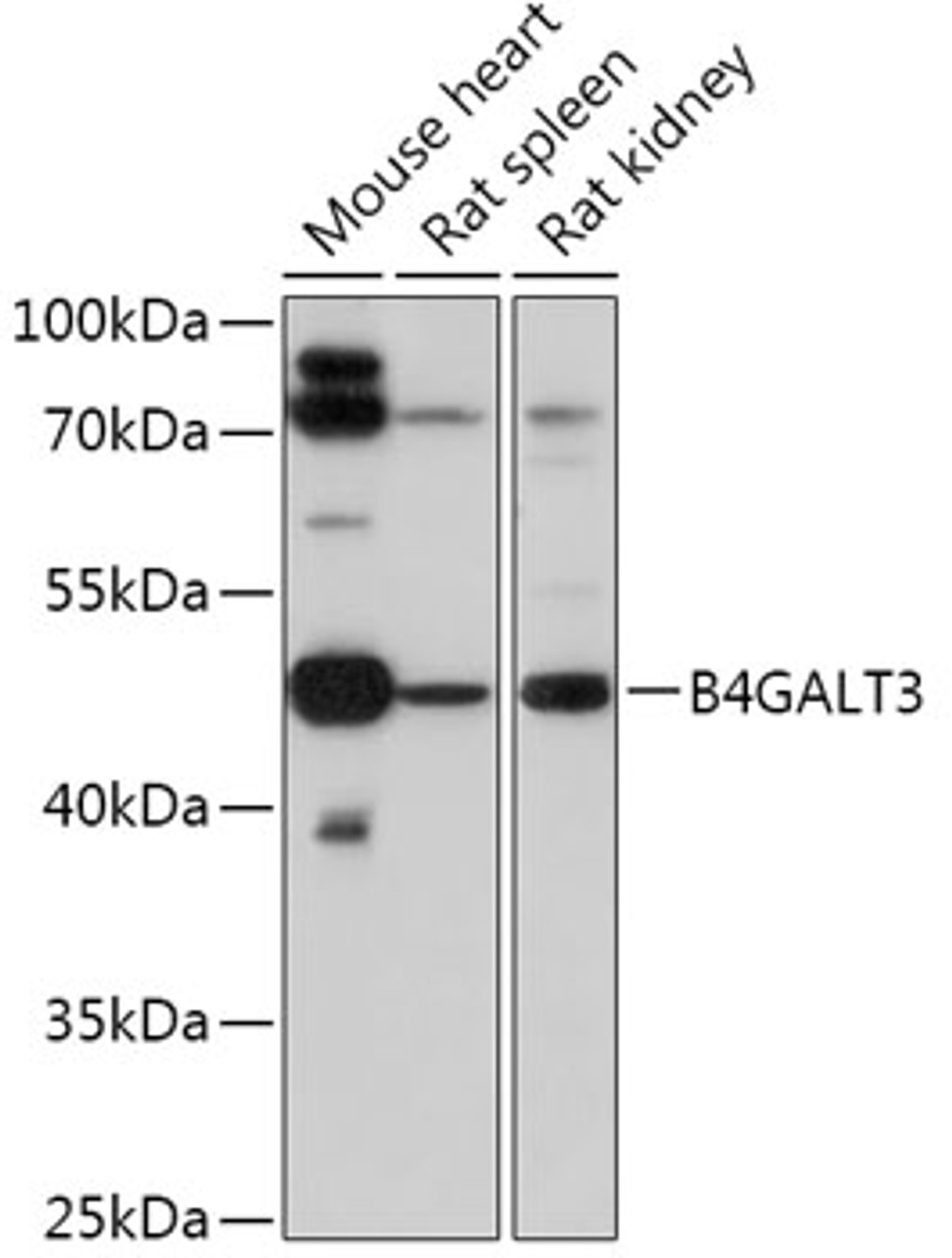 Western blot analysis of extracts of various cell lines, using B4GALT3 antibody (16-988) at 1:1000 dilution.<br/>Secondary antibody: HRP Goat Anti-Rabbit IgG (H+L) at 1:10000 dilution.<br/>Lysates/proteins: 25ug per lane.<br/>Blocking buffer: 3% nonfat dry milk in TBST.<br/>Detection: ECL Basic Kit.<br/>Exposure time: 30s.