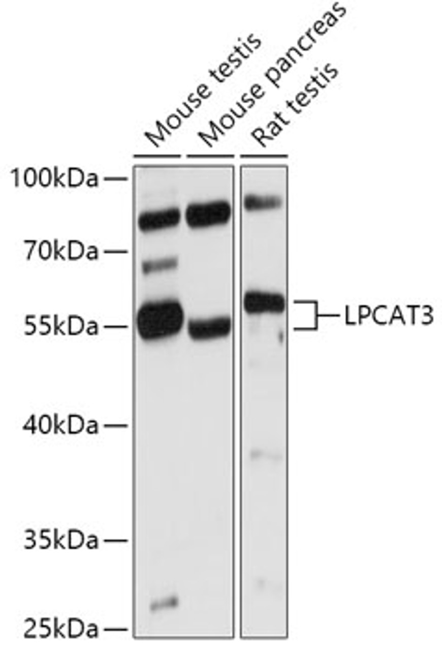 Western blot analysis of extracts of various cell lines, using LPCAT3 antibody (16-999) at 1:1000 dilution.<br/>Secondary antibody: HRP Goat Anti-Rabbit IgG (H+L) at 1:10000 dilution.<br/>Lysates/proteins: 25ug per lane.<br/>Blocking buffer: 3% nonfat dry milk in TBST.<br/>Detection: ECL Basic Kit.<br/>Exposure time: 10s.