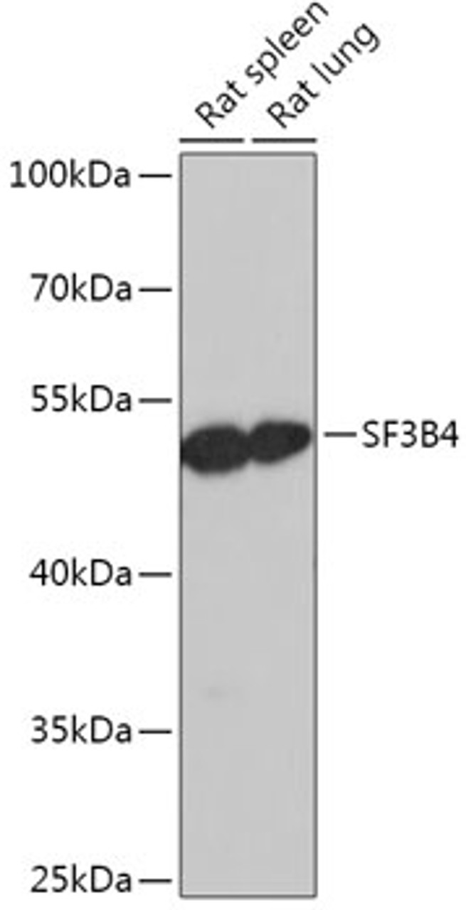 Western blot analysis of extracts of various cell lines, using SF3B4 antibody (18-001) at 1:1000 dilution.<br/>Secondary antibody: HRP Goat Anti-Rabbit IgG (H+L) at 1:10000 dilution.<br/>Lysates/proteins: 25ug per lane.<br/>Blocking buffer: 3% nonfat dry milk in TBST.<br/>Detection: ECL Basic Kit.<br/>Exposure time: 1s.