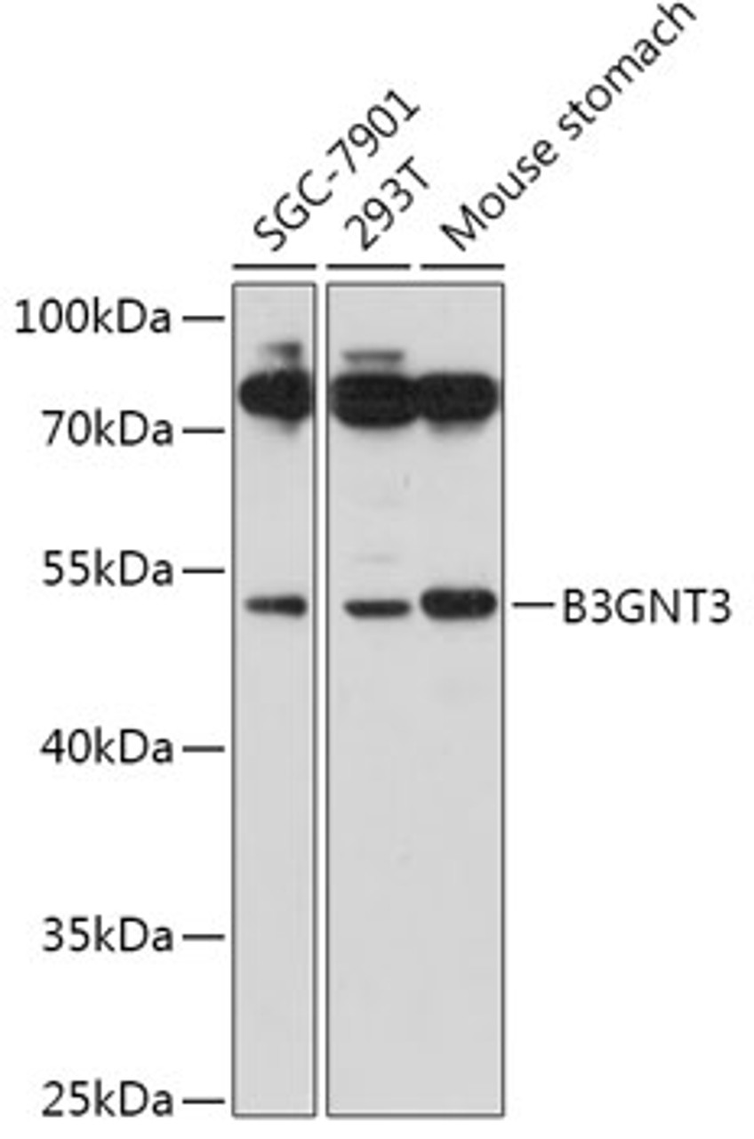 Western blot analysis of extracts of various cell lines, using B3GNT3 antibody (18-003) at 1:1000 dilution.<br/>Secondary antibody: HRP Goat Anti-Rabbit IgG (H+L) at 1:10000 dilution.<br/>Lysates/proteins: 25ug per lane.<br/>Blocking buffer: 3% nonfat dry milk in TBST.<br/>Detection: ECL Basic Kit.<br/>Exposure time: 180s.