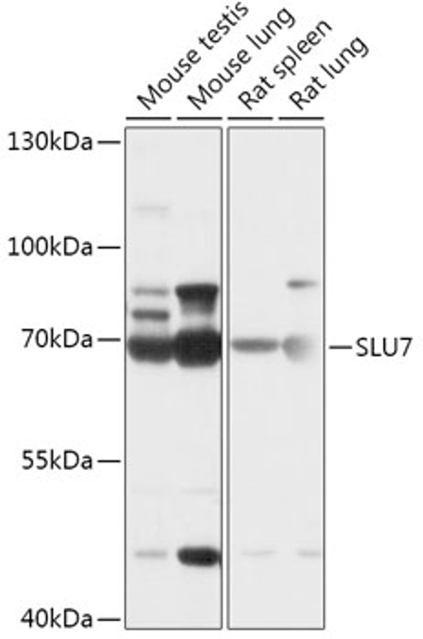 Western blot analysis of extracts of various cell lines, using SLU7 antibody (18-004) at 1:1000 dilution.<br/>Secondary antibody: HRP Goat Anti-Rabbit IgG (H+L) at 1:10000 dilution.<br/>Lysates/proteins: 25ug per lane.<br/>Blocking buffer: 3% nonfat dry milk in TBST.<br/>Detection: ECL Basic Kit.<br/>Exposure time: 30s.