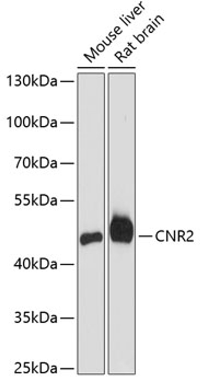 Western blot analysis of extracts of various cell lines, using CNR2 antibody (18-009) at 1:3000 dilution.<br/>Secondary antibody: HRP Goat Anti-Rabbit IgG (H+L) at 1:10000 dilution.<br/>Lysates/proteins: 25ug per lane.<br/>Blocking buffer: 3% nonfat dry milk in TBST.<br/>Detection: ECL Enhanced Kit.<br/>Exposure time: 90s.