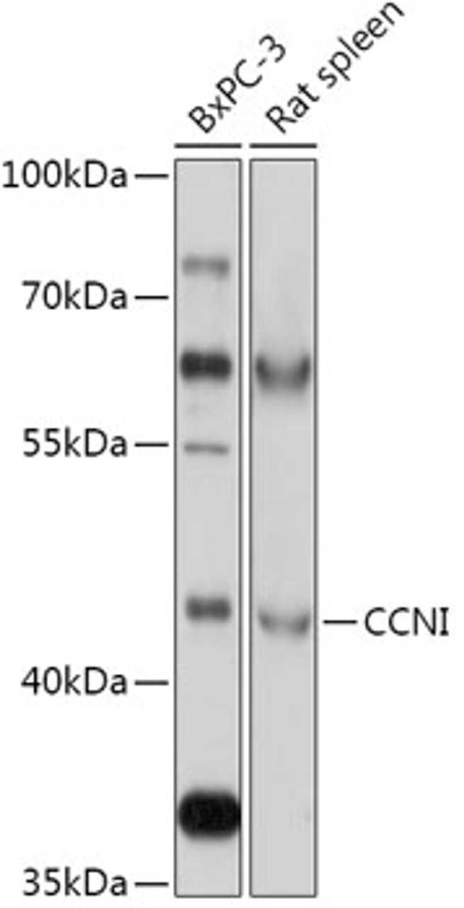 Western blot analysis of extracts of various cell lines, using CCNI antibody (18-012) at 1:1000 dilution.<br/>Secondary antibody: HRP Goat Anti-Rabbit IgG (H+L) at 1:10000 dilution.<br/>Lysates/proteins: 25ug per lane.<br/>Blocking buffer: 3% nonfat dry milk in TBST.<br/>Detection: ECL Basic Kit.<br/>Exposure time: 10s.