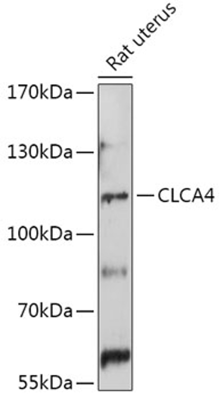 Western blot analysis of extracts of Rat uterus, using CLCA4 antibody (18-018) at 1:1000 dilution.<br/>Secondary antibody: HRP Goat Anti-Rabbit IgG (H+L) at 1:10000 dilution.<br/>Lysates/proteins: 25ug per lane.<br/>Blocking buffer: 3% nonfat dry milk in TBST.<br/>Detection: ECL Basic Kit.<br/>Exposure time: 90s.