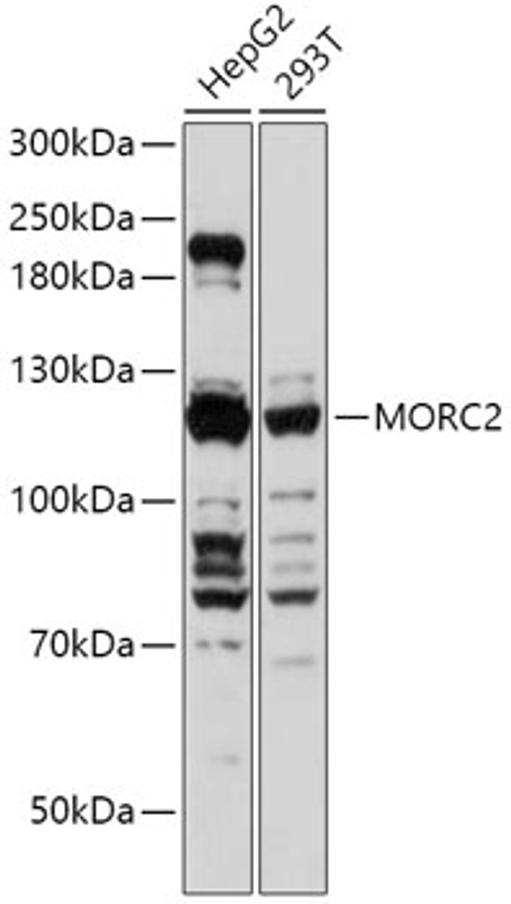 Western blot analysis of extracts of various cell lines, using MORC2 antibody (18-020) at 1:1000 dilution.<br/>Secondary antibody: HRP Goat Anti-Rabbit IgG (H+L) at 1:10000 dilution.<br/>Lysates/proteins: 25ug per lane.<br/>Blocking buffer: 3% nonfat dry milk in TBST.<br/>Detection: ECL Basic Kit.<br/>Exposure time: 5s.