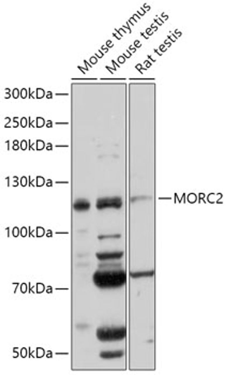 Western blot analysis of extracts of various cell lines, using MORC2 antibody (18-020) at 1:1000 dilution.<br/>Secondary antibody: HRP Goat Anti-Rabbit IgG (H+L) at 1:10000 dilution.<br/>Lysates/proteins: 25ug per lane.<br/>Blocking buffer: 3% nonfat dry milk in TBST.<br/>Detection: ECL Basic Kit.<br/>Exposure time: 60s.