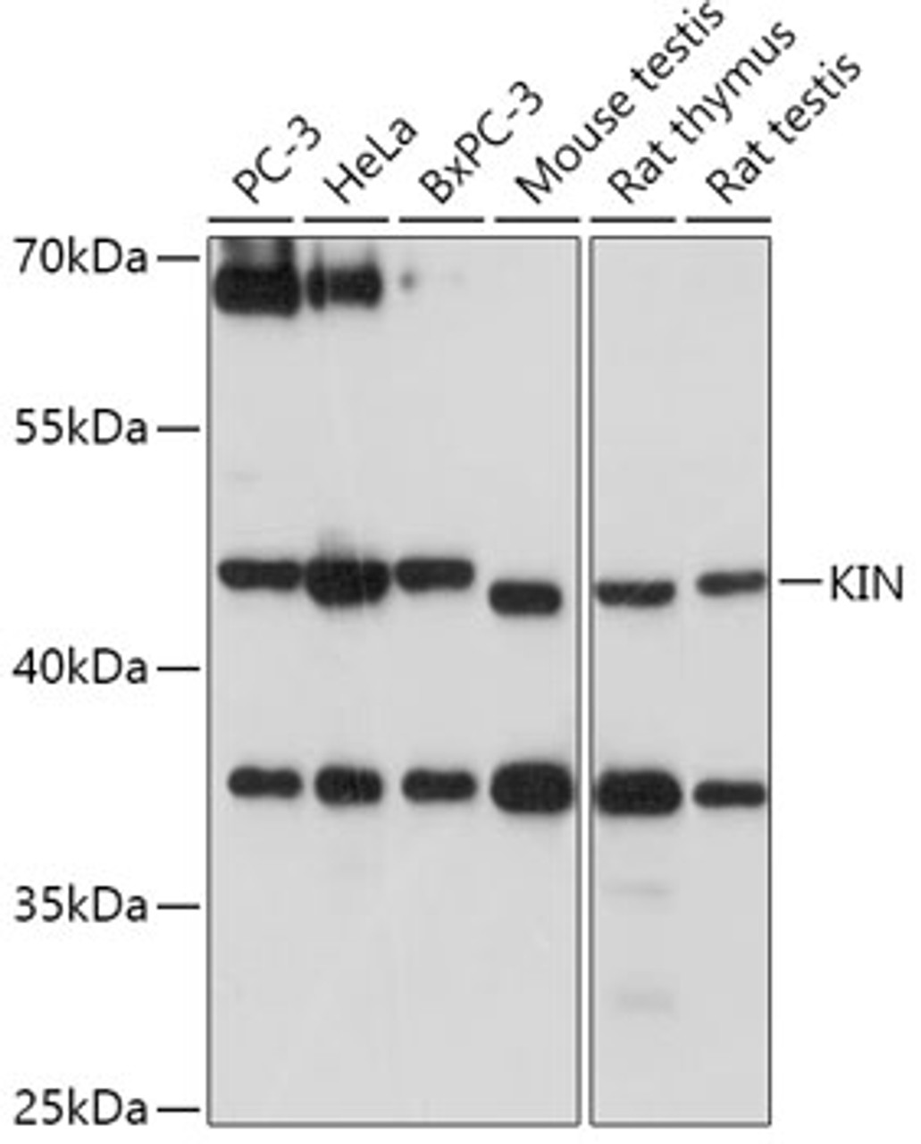 Western blot analysis of extracts of various cell lines, using KIN antibody (18-023) at 1:1000 dilution.<br/>Secondary antibody: HRP Goat Anti-Rabbit IgG (H+L) at 1:10000 dilution.<br/>Lysates/proteins: 25ug per lane.<br/>Blocking buffer: 3% nonfat dry milk in TBST.<br/>Detection: ECL Basic Kit.<br/>Exposure time: 60s.