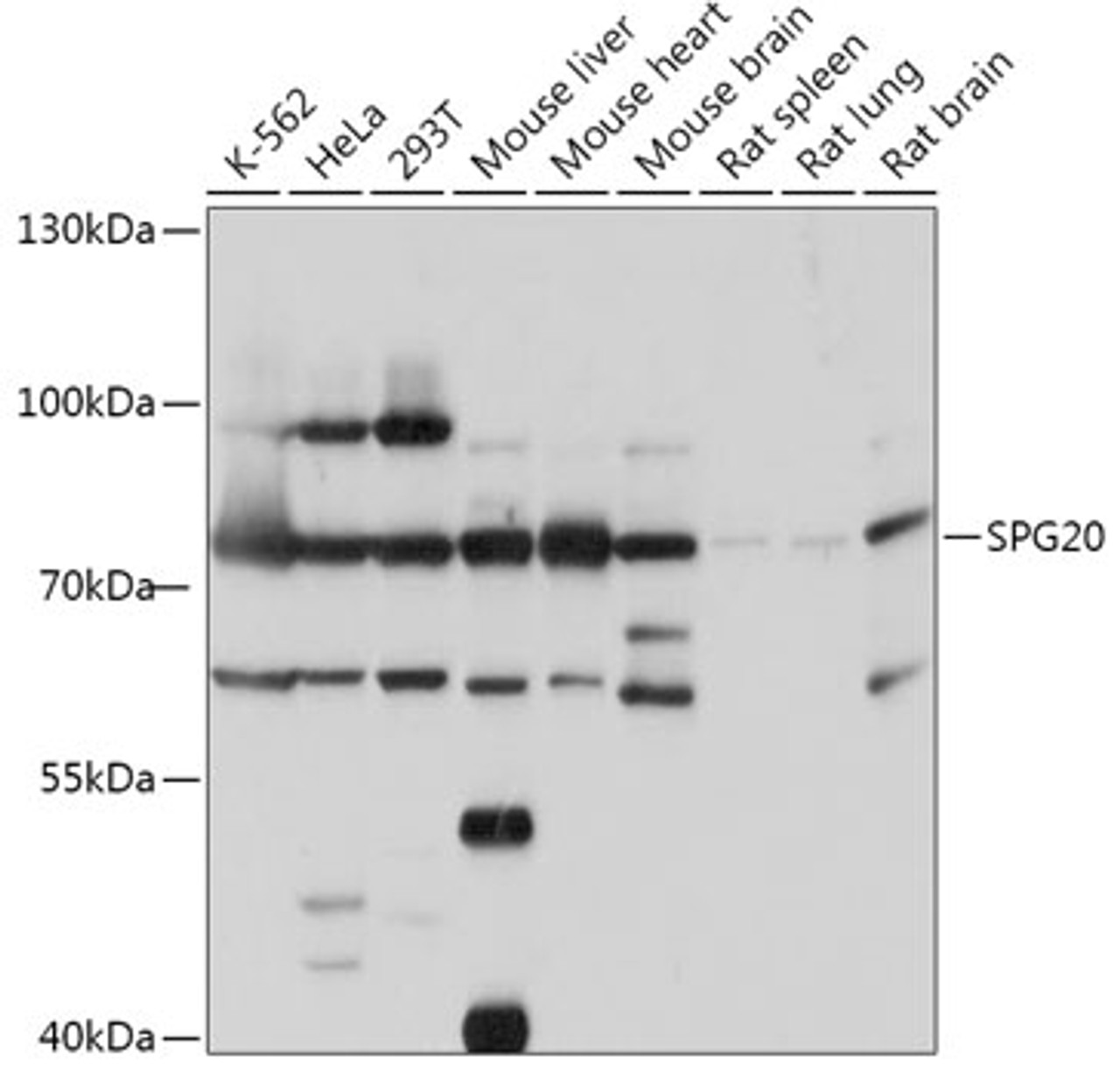 Western blot analysis of extracts of various cell lines, using SPG20 antibody (18-028) at 1:1000 dilution.<br/>Secondary antibody: HRP Goat Anti-Rabbit IgG (H+L) at 1:10000 dilution.<br/>Lysates/proteins: 25ug per lane.<br/>Blocking buffer: 3% nonfat dry milk in TBST.<br/>Detection: ECL Basic Kit.<br/>Exposure time: 30s.