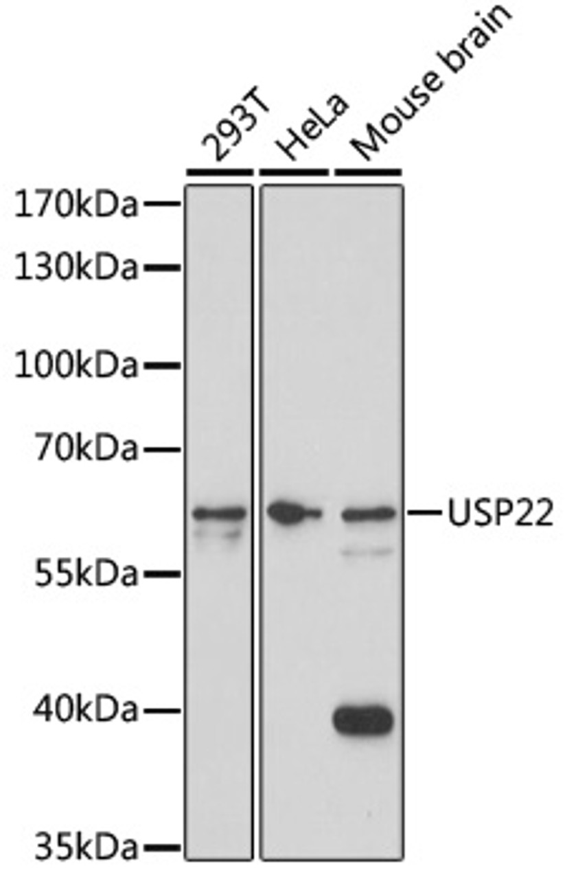 Western blot analysis of extracts of various cell lines, using USP22 antibody (18-032) at 1:1000 dilution.<br/>Secondary antibody: HRP Goat Anti-Rabbit IgG (H+L) at 1:10000 dilution.<br/>Lysates/proteins: 25ug per lane.<br/>Blocking buffer: 3% nonfat dry milk in TBST.<br/>Detection: ECL Basic Kit.<br/>Exposure time: 5min.