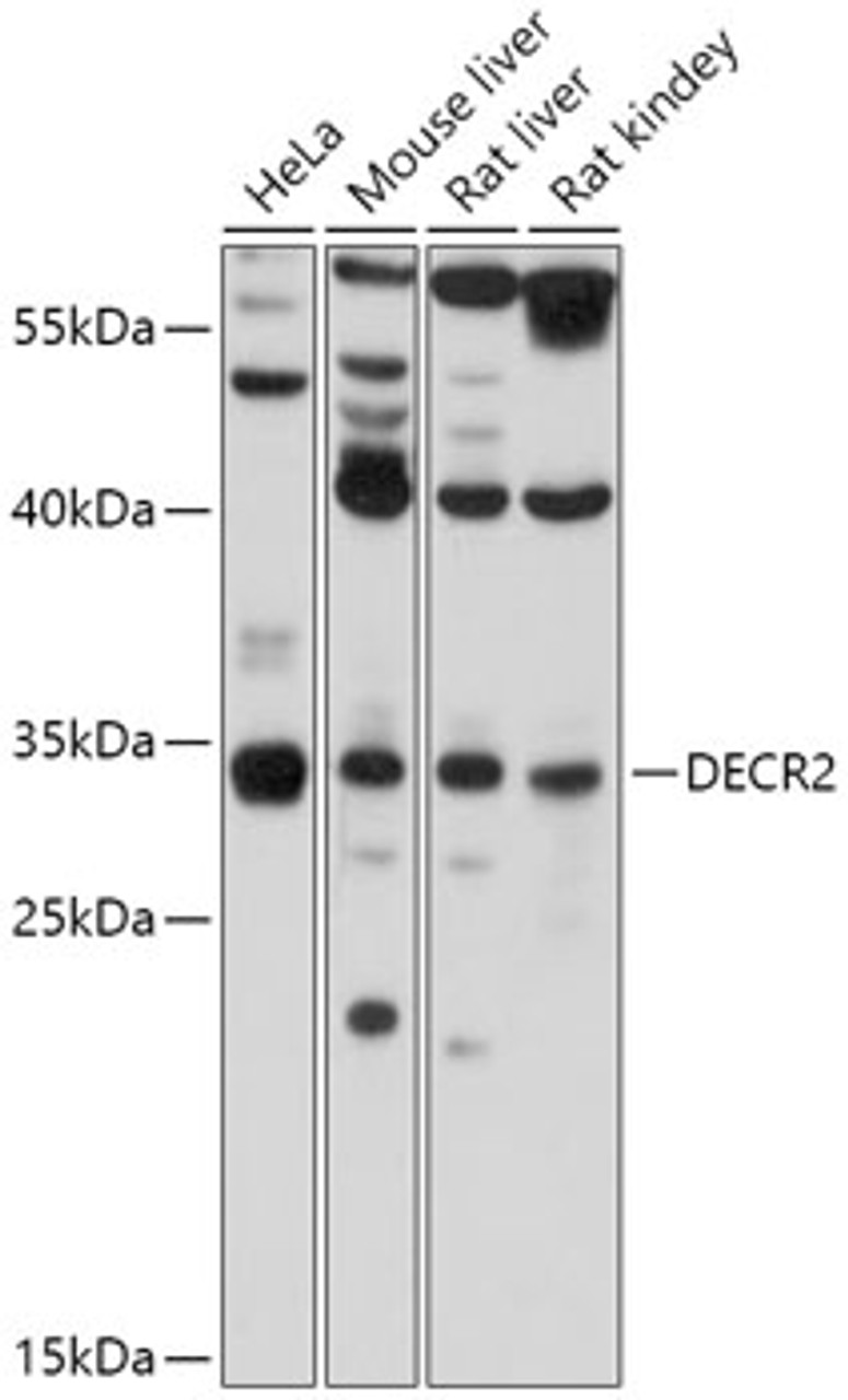 Western blot analysis of extracts of various cell lines, using DECR2 antibody (18-039) at 1:1000 dilution.<br/>Secondary antibody: HRP Goat Anti-Rabbit IgG (H+L) at 1:10000 dilution.<br/>Lysates/proteins: 25ug per lane.<br/>Blocking buffer: 3% nonfat dry milk in TBST.<br/>Detection: ECL Basic Kit.<br/>Exposure time: 3s.