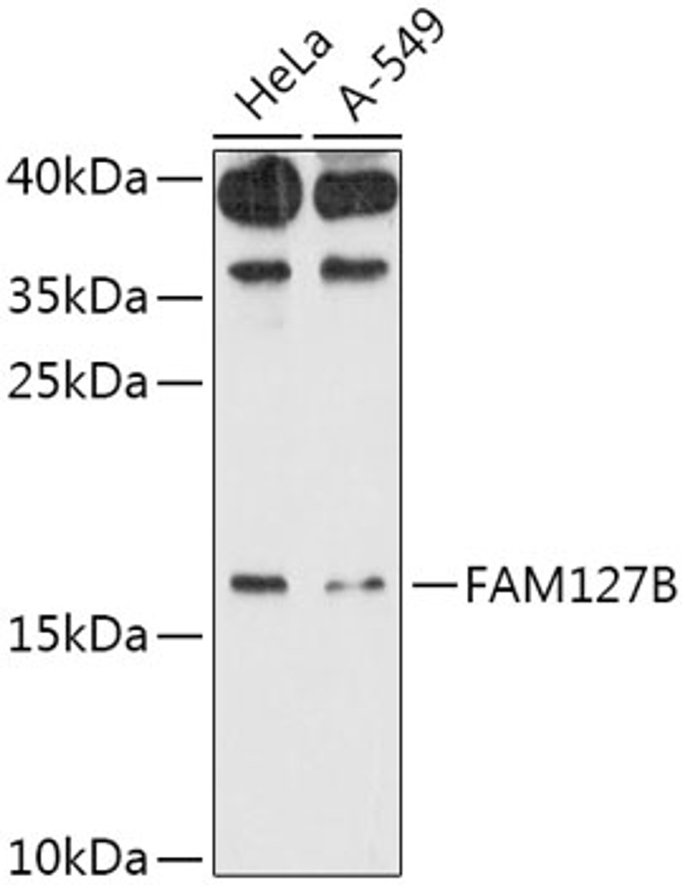 Western blot analysis of extracts of various cell lines, using FAM127B antibody (18-040) at 1:1000 dilution.<br/>Secondary antibody: HRP Goat Anti-Rabbit IgG (H+L) at 1:10000 dilution.<br/>Lysates/proteins: 25ug per lane.<br/>Blocking buffer: 3% nonfat dry milk in TBST.<br/>Detection: ECL Basic Kit.<br/>Exposure time: 90s.