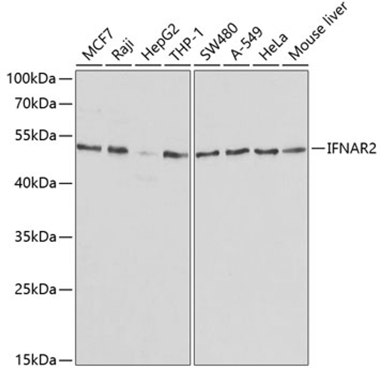 Western blot analysis of extracts of various cell lines, using IFNAR2 antibody (18-046) at 1:1000 dilution.<br/>Secondary antibody: HRP Goat Anti-Rabbit IgG (H+L) at 1:10000 dilution.<br/>Lysates/proteins: 25ug per lane.<br/>Blocking buffer: 3% nonfat dry milk in TBST.