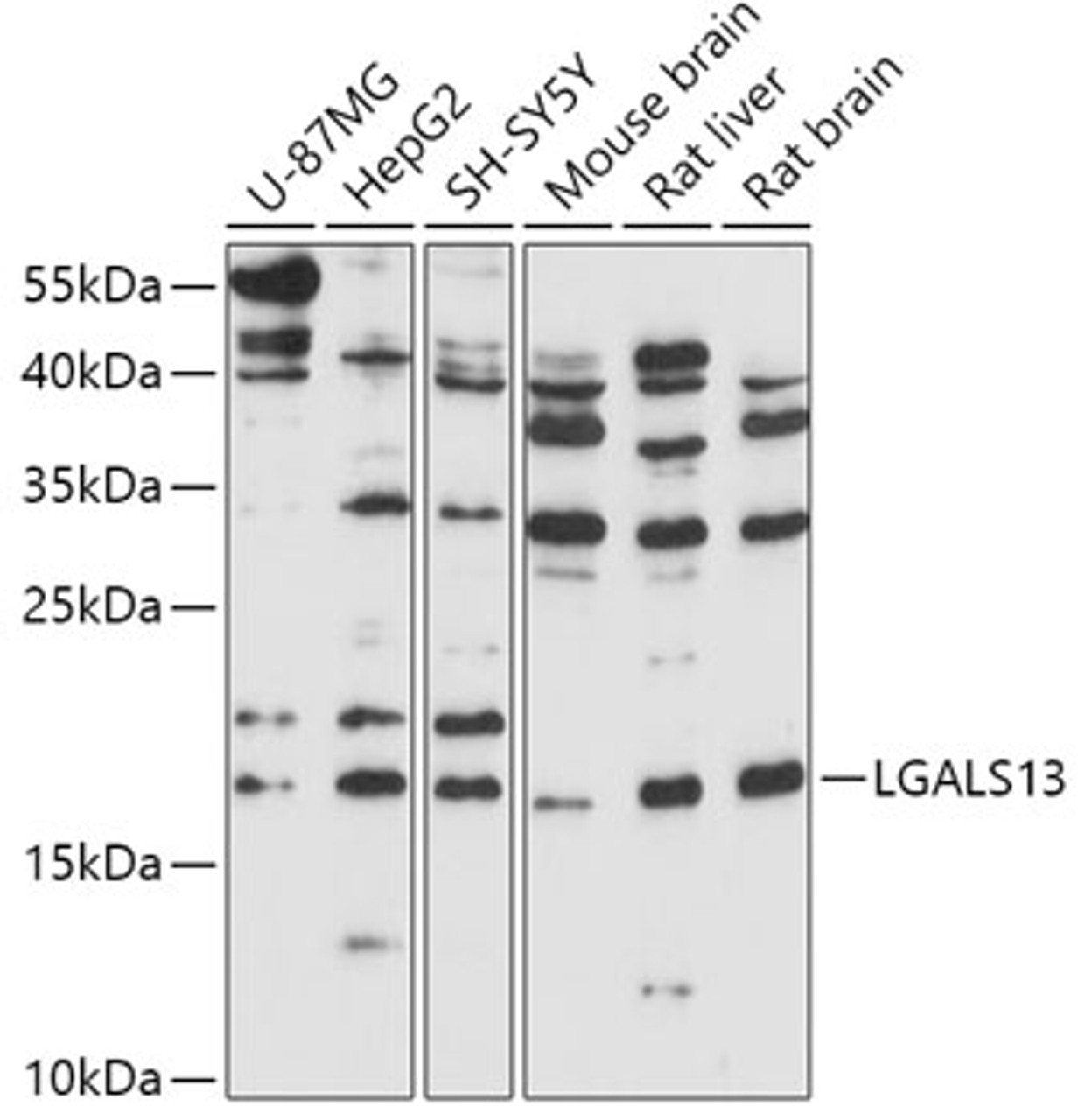 Western blot analysis of extracts of various cell lines, using LGALS13 antibody (18-048) at 1:1000 dilution.<br/>Secondary antibody: HRP Goat Anti-Rabbit IgG (H+L) at 1:10000 dilution.<br/>Lysates/proteins: 25ug per lane.<br/>Blocking buffer: 3% nonfat dry milk in TBST.<br/>Detection: ECL Basic Kit.<br/>Exposure time: 180s.