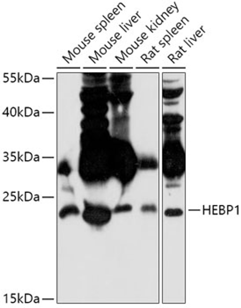 Western blot analysis of extracts of various cell lines, using HEBP1 antibody (18-052) at 1:1000 dilution.<br/>Secondary antibody: HRP Goat Anti-Rabbit IgG (H+L) at 1:10000 dilution.<br/>Lysates/proteins: 25ug per lane.<br/>Blocking buffer: 3% nonfat dry milk in TBST.<br/>Detection: ECL Basic Kit.<br/>Exposure time: 3min.