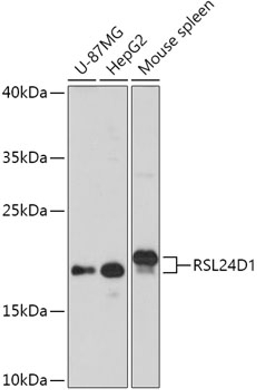 Western blot analysis of extracts of various cell lines, using RSL24D1 antibody (18-054) at 1:1000 dilution.<br/>Secondary antibody: HRP Goat Anti-Rabbit IgG (H+L) at 1:10000 dilution.<br/>Lysates/proteins: 25ug per lane.<br/>Blocking buffer: 3% nonfat dry milk in TBST.<br/>Detection: ECL Basic Kit.<br/>Exposure time: 3min.