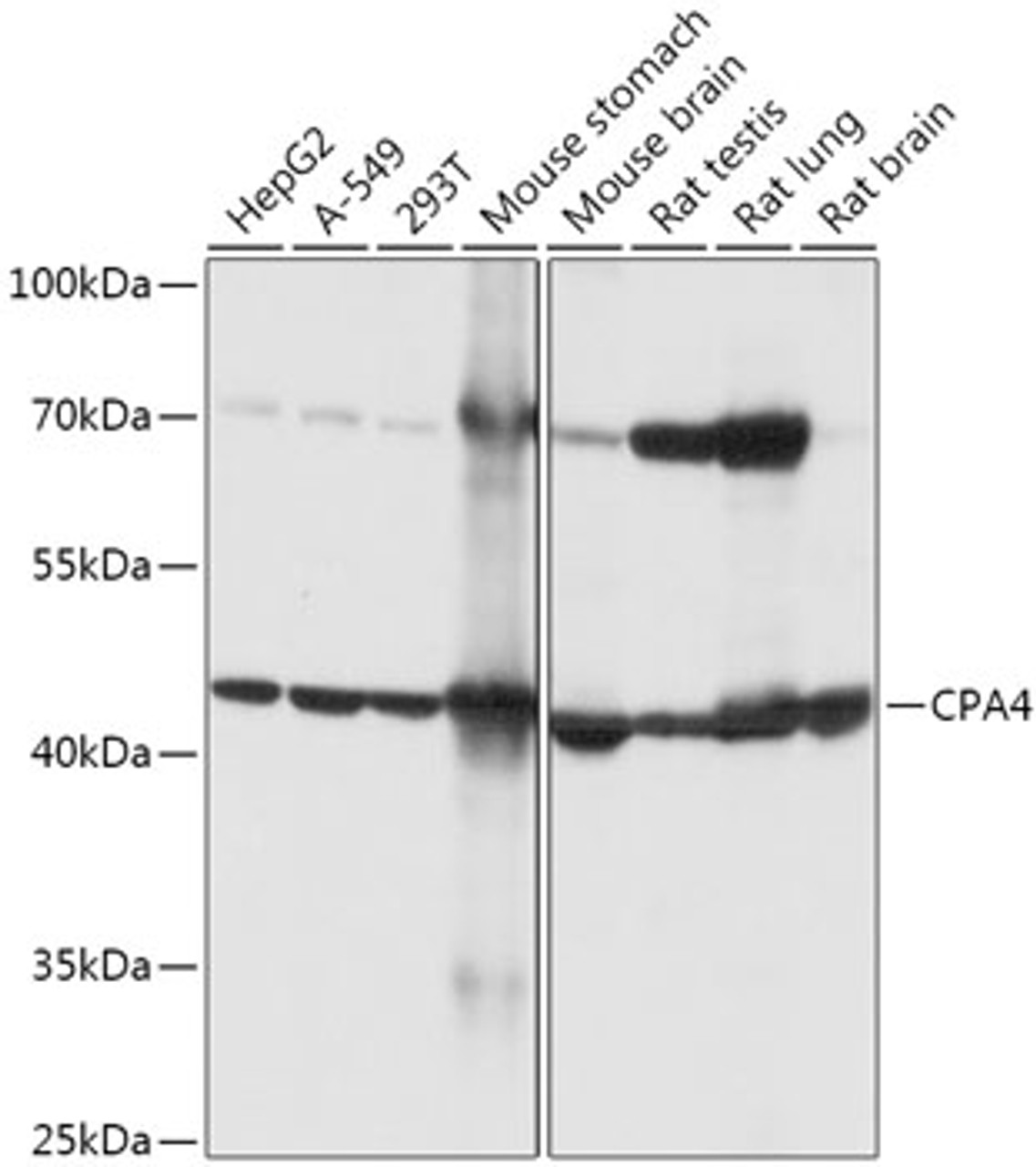 Western blot analysis of extracts of various cell lines, using CPA4 antibody (18-055) at 1:1000 dilution.<br/>Secondary antibody: HRP Goat Anti-Rabbit IgG (H+L) at 1:10000 dilution.<br/>Lysates/proteins: 25ug per lane.<br/>Blocking buffer: 3% nonfat dry milk in TBST.<br/>Detection: ECL Basic Kit.<br/>Exposure time: 5s.