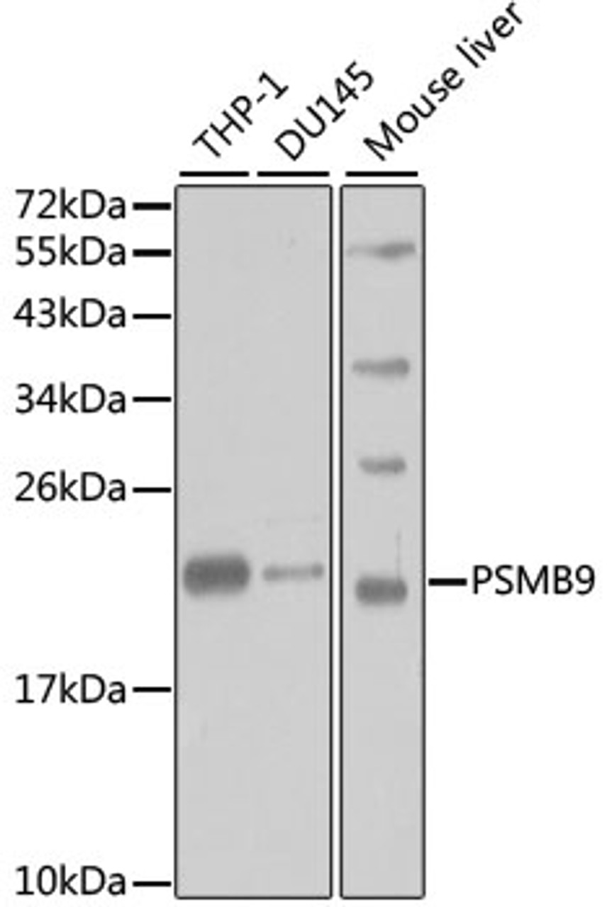 Western blot analysis of extracts of various cell lines, using PSMB9 antibody (18-060) at 1:1000 dilution.<br/>Secondary antibody: HRP Goat Anti-Rabbit IgG (H+L) at 1:10000 dilution.<br/>Lysates/proteins: 25ug per lane.<br/>Blocking buffer: 3% nonfat dry milk in TBST.<br/>Detection: ECL Basic Kit.