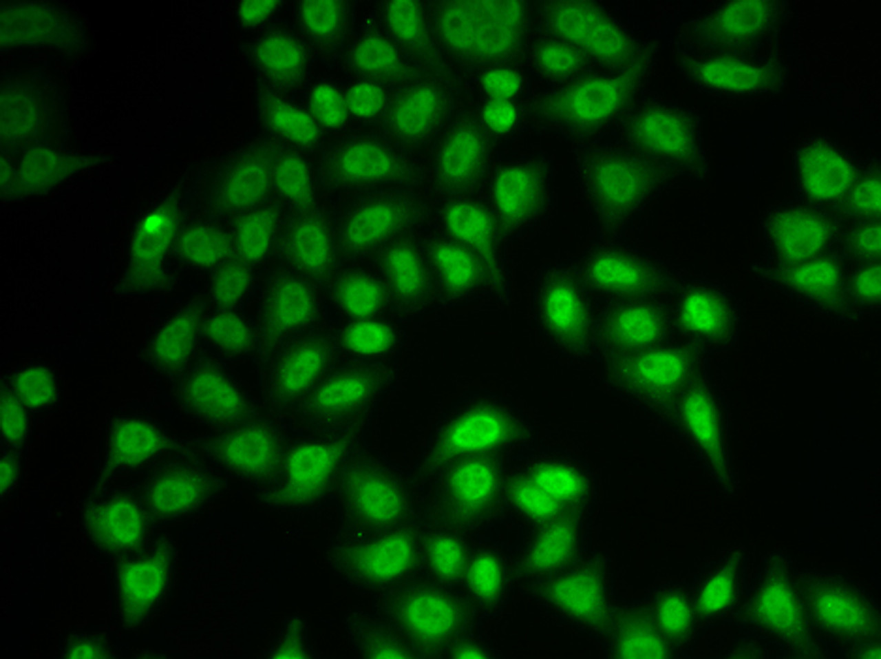 Immunofluorescence analysis of MCF-7 cells using PSMB9 antibody (18-060) .