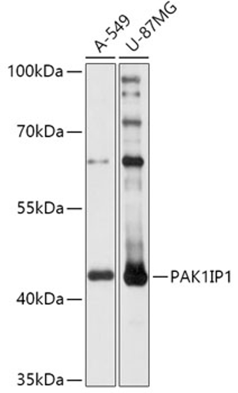 Western blot analysis of extracts of various cell lines, using PAK1IP1 antibody (18-063) at 1:1000 dilution.<br/>Secondary antibody: HRP Goat Anti-Rabbit IgG (H+L) at 1:10000 dilution.<br/>Lysates/proteins: 25ug per lane.<br/>Blocking buffer: 3% nonfat dry milk in TBST.<br/>Detection: ECL Basic Kit.<br/>Exposure time: 10s.