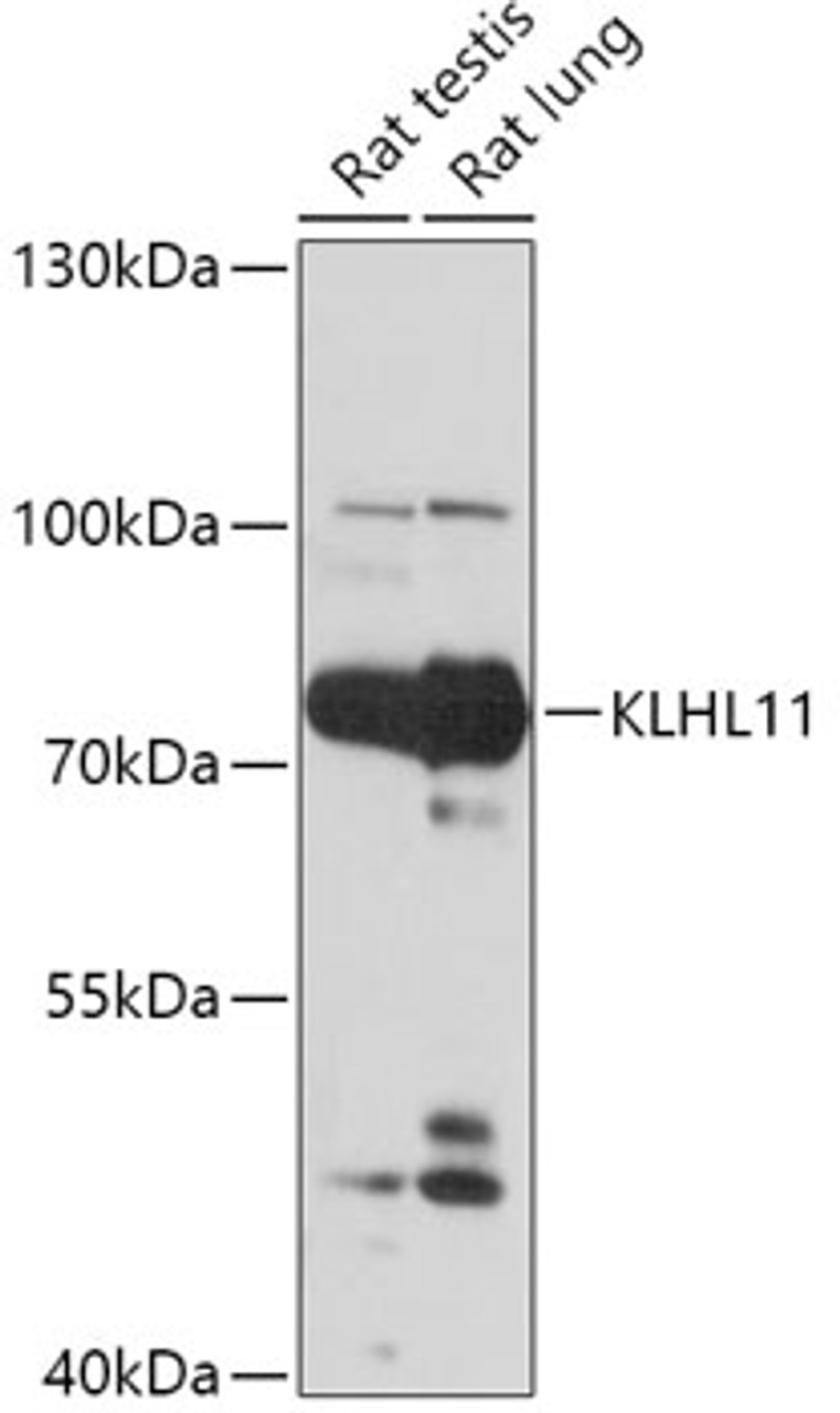 Western blot analysis of extracts of various cell lines, using KLHL11 antibody (18-067) at 1:1000 dilution.<br/>Secondary antibody: HRP Goat Anti-Rabbit IgG (H+L) at 1:10000 dilution.<br/>Lysates/proteins: 25ug per lane.<br/>Blocking buffer: 3% nonfat dry milk in TBST.<br/>Detection: ECL Basic Kit.<br/>Exposure time: 30s.