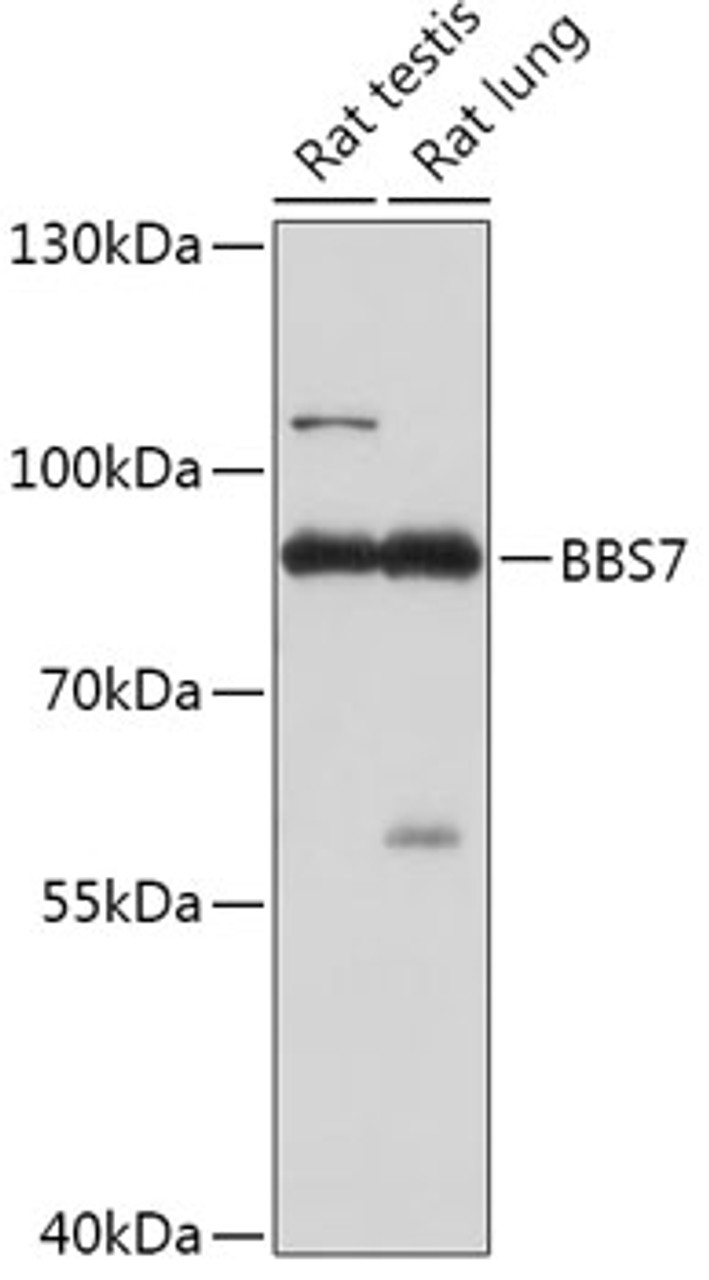 Western blot analysis of extracts of various cell lines, using BBS7 antibody (18-068) at 1:1000 dilution.<br/>Secondary antibody: HRP Goat Anti-Rabbit IgG (H+L) at 1:10000 dilution.<br/>Lysates/proteins: 25ug per lane.<br/>Blocking buffer: 3% nonfat dry milk in TBST.<br/>Detection: ECL Basic Kit.<br/>Exposure time: 30s.