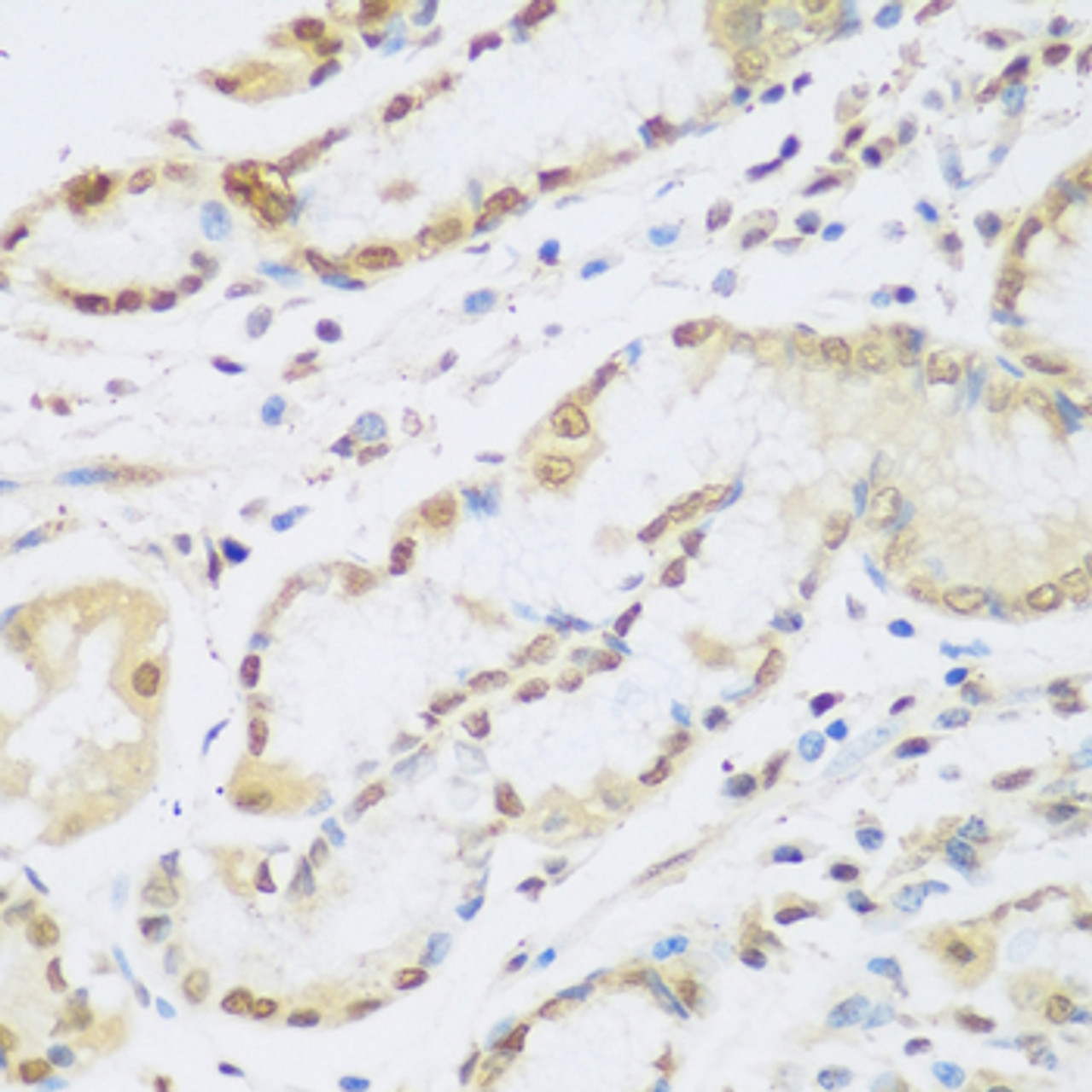 Immunohistochemistry of paraffin-embedded human stomach using Cyclin D2 antibody (18-075) at dilution of 1:100 (40x lens) .