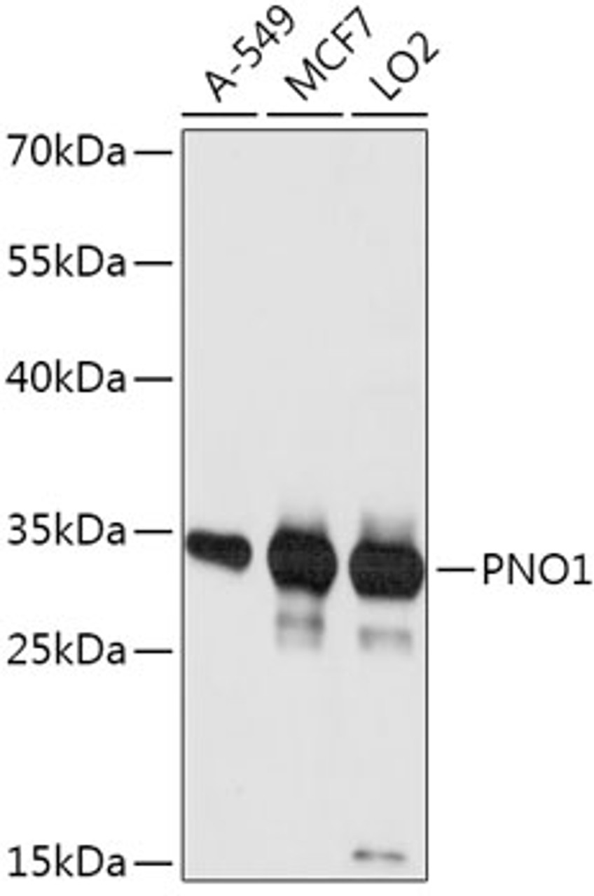 Western blot analysis of extracts of various cell lines, using PNO1 antibody (18-081) at 1:1000 dilution.<br/>Secondary antibody: HRP Goat Anti-Rabbit IgG (H+L) at 1:10000 dilution.<br/>Lysates/proteins: 25ug per lane.<br/>Blocking buffer: 3% nonfat dry milk in TBST.<br/>Detection: ECL Basic Kit.<br/>Exposure time: 10s.